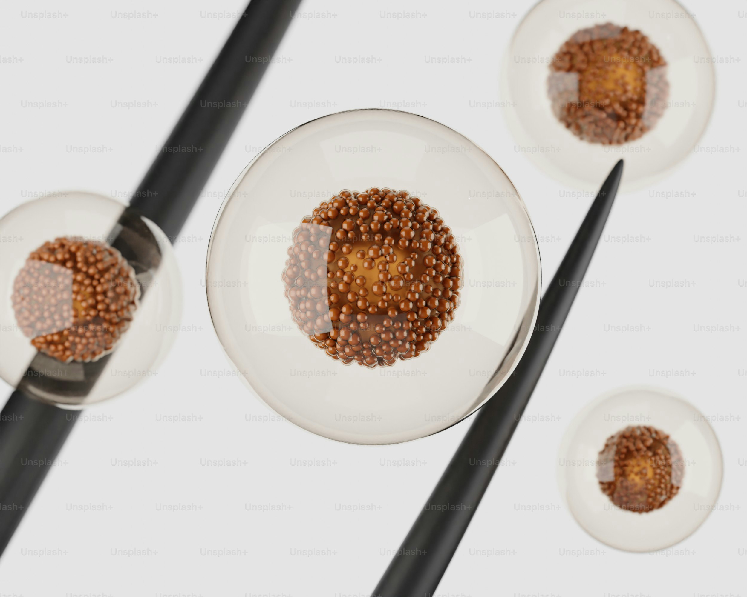 Transparent cells with granular centers and black needles.