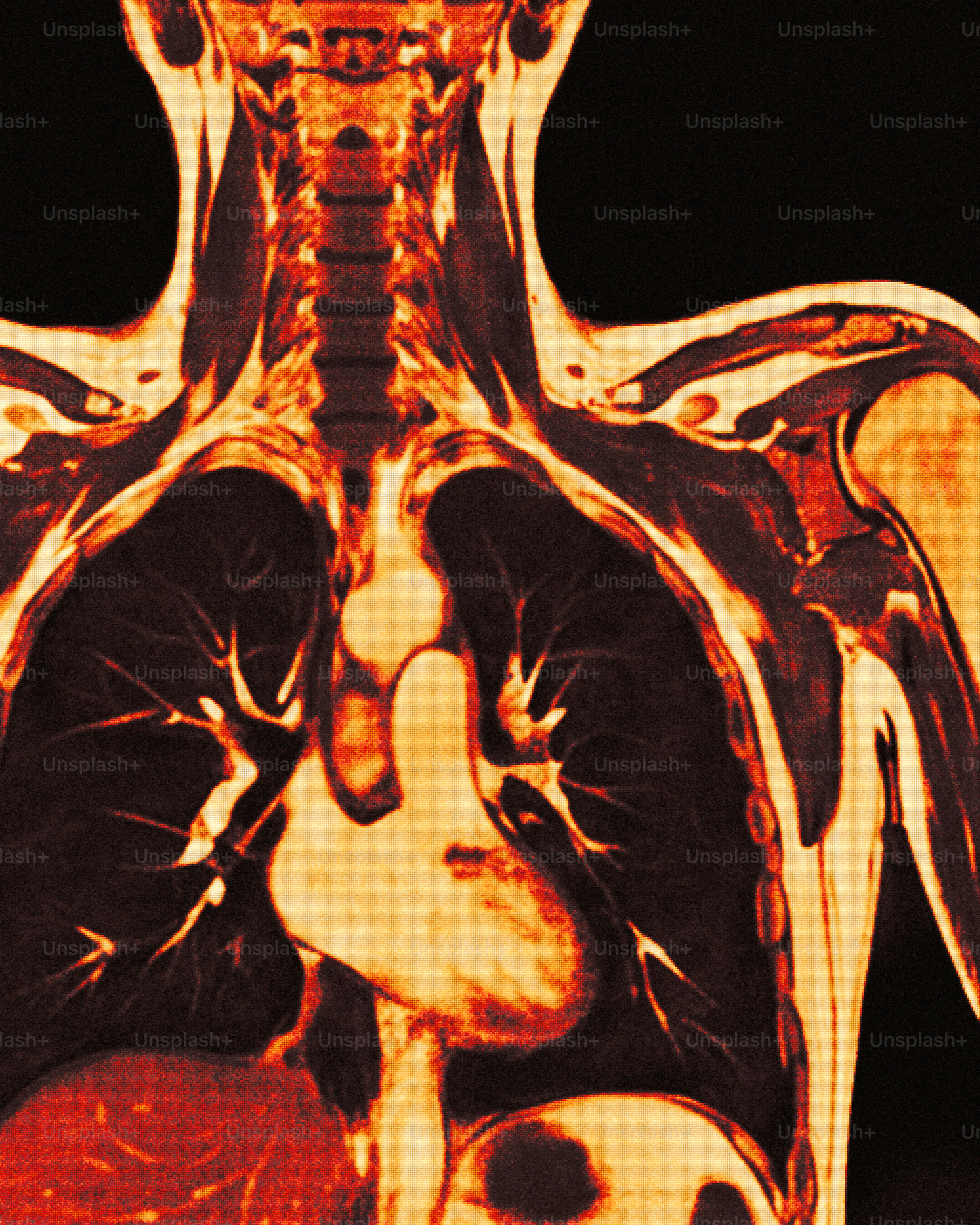 Colorful mri scan of human torso, heart, and lungs.