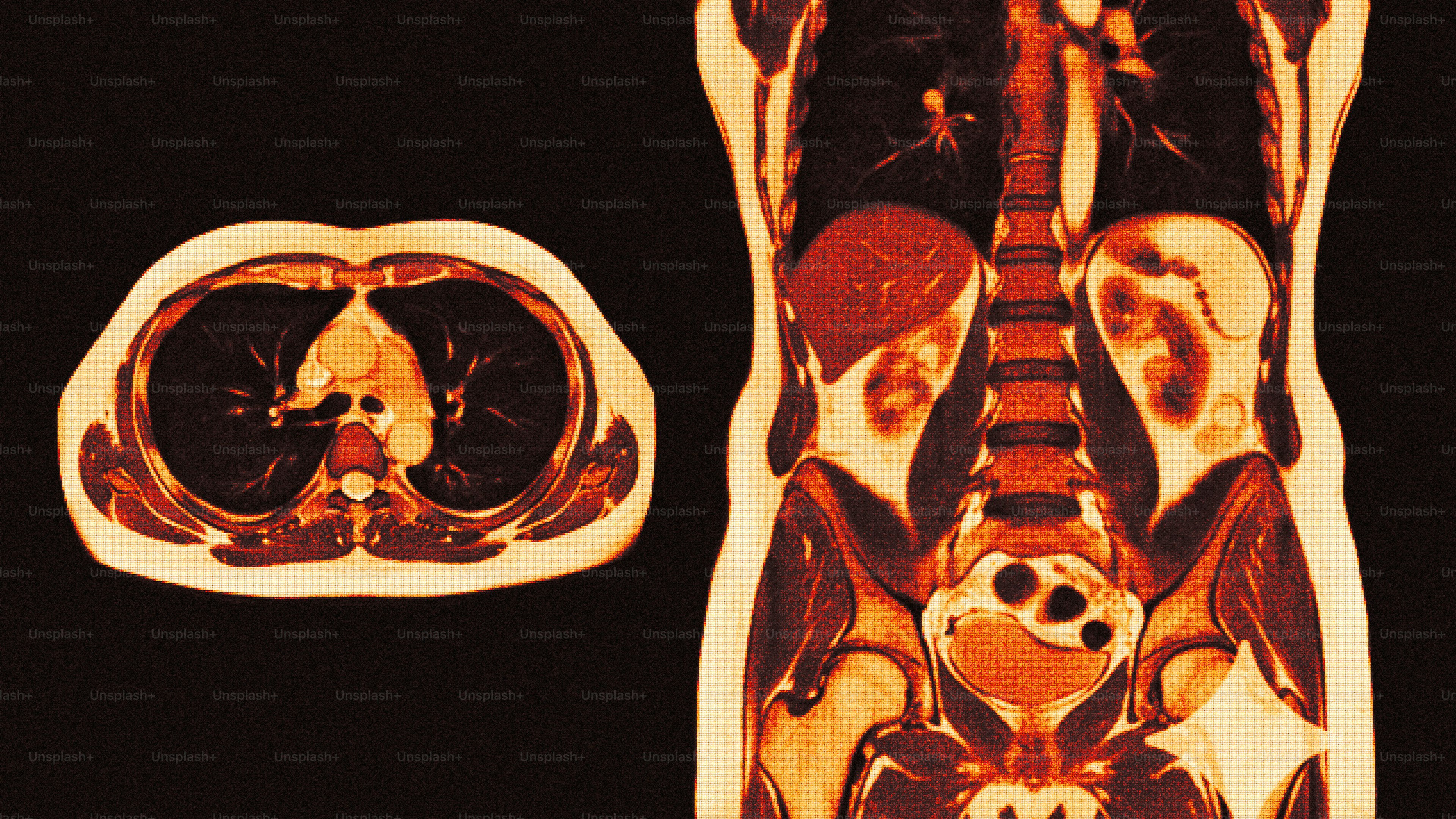 Medical scans showing human torso and internal organs.