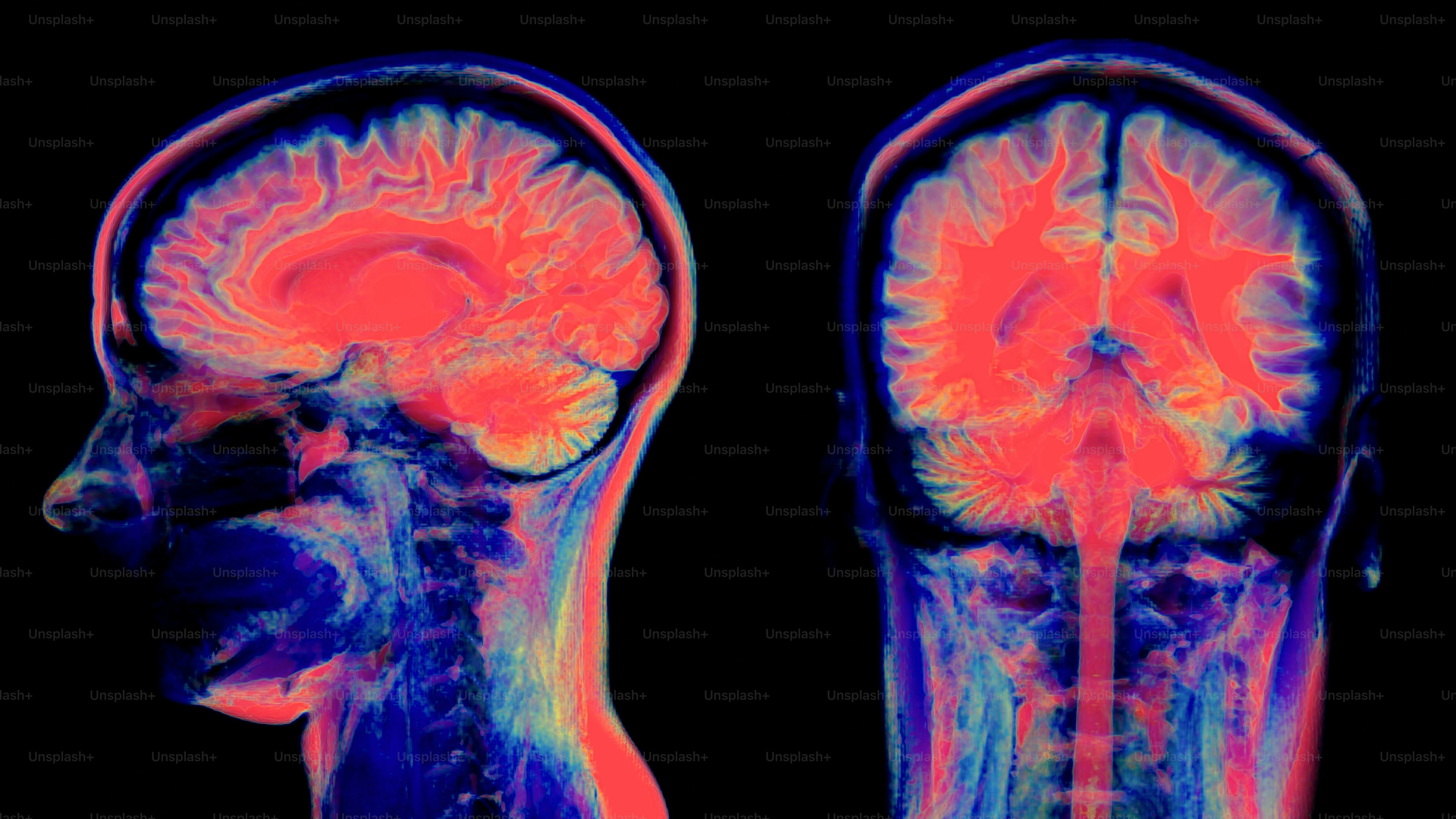 Vibrant mri scans of a human brain.