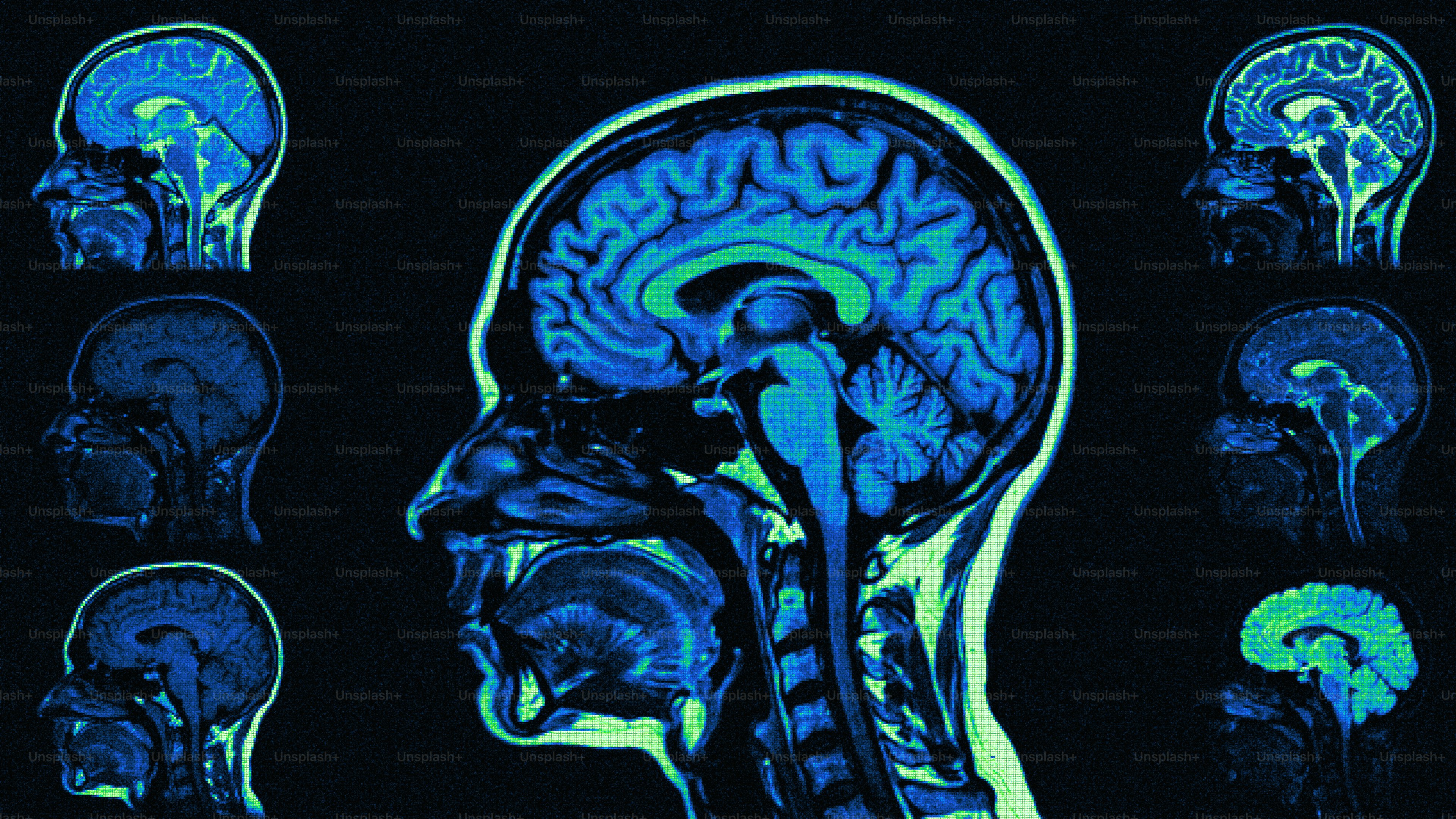 Multiple blue mri scans of a human brain.