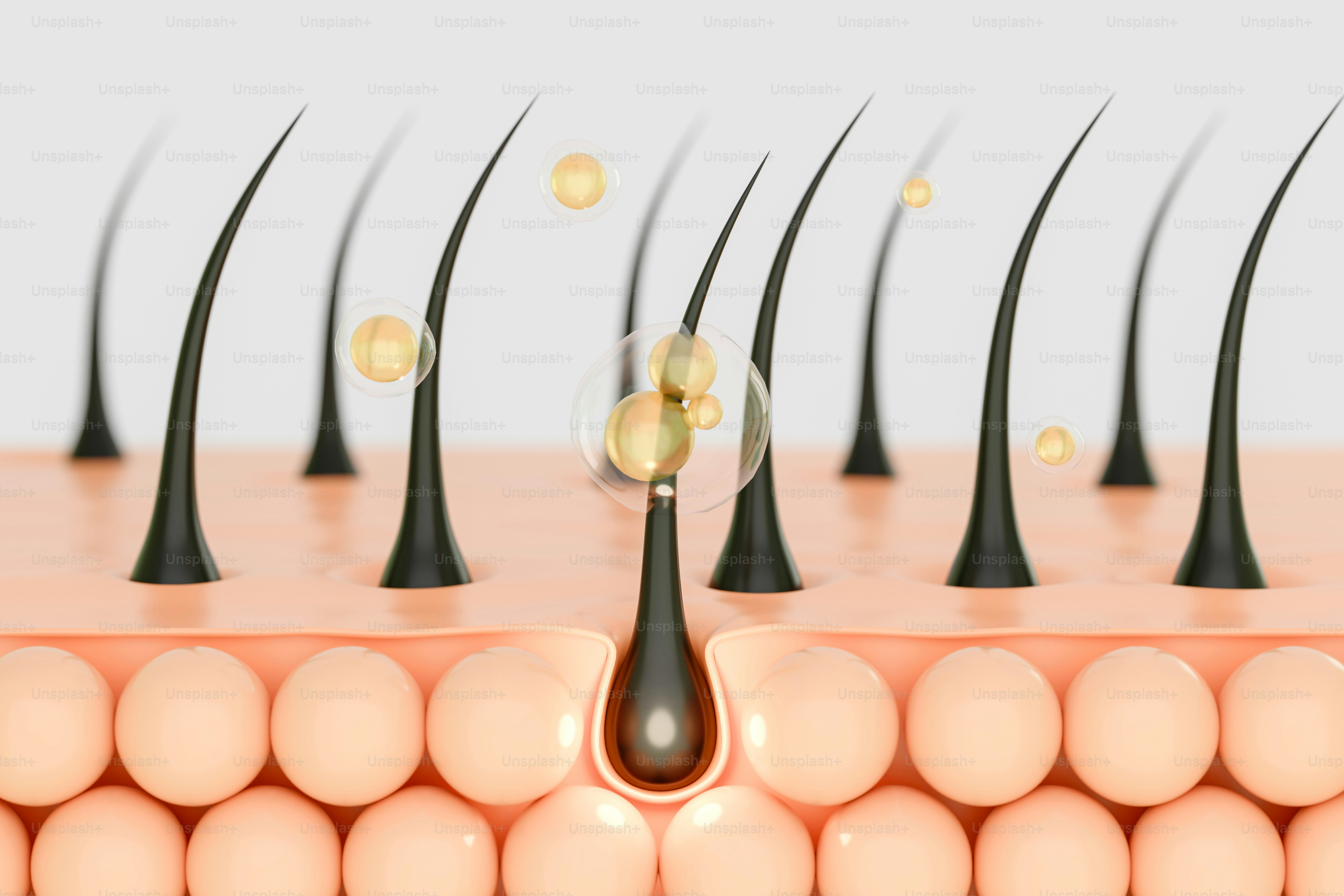 Folikel rambut dengan tetesan serum dan gelembung pada kulit.