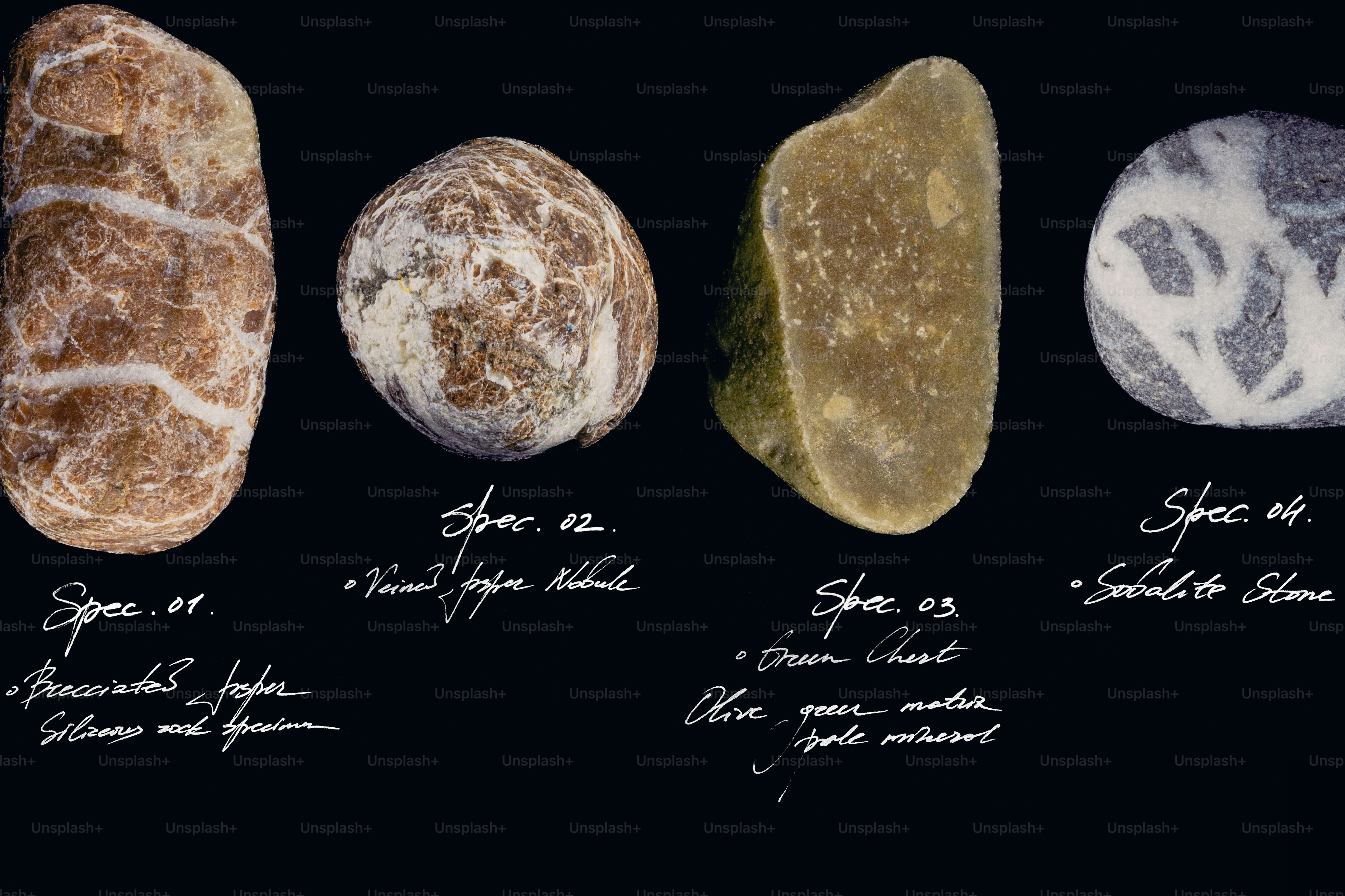 Various gallstones with handwritten labels on a dark background.