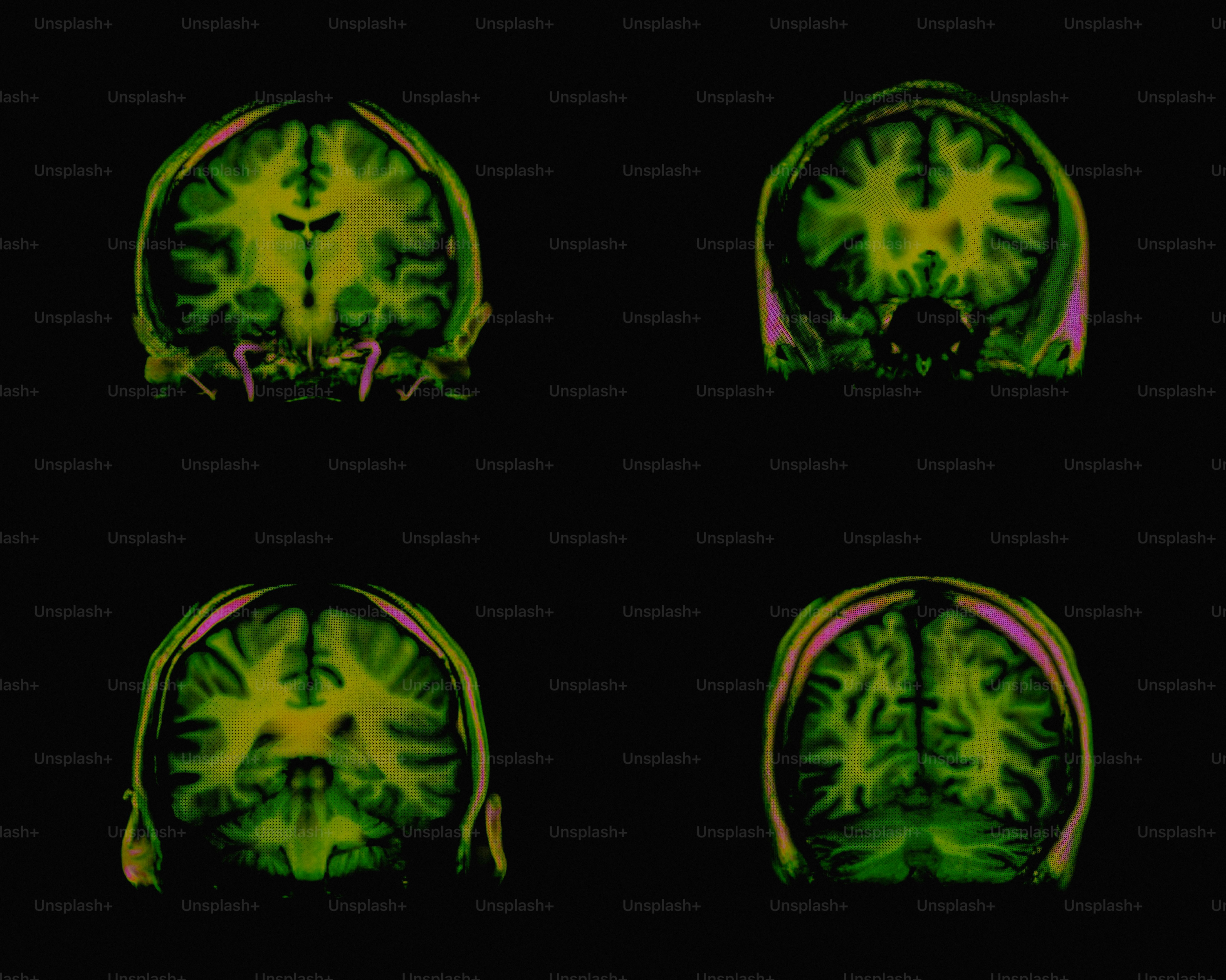 Four colorful brain scans displayed against a dark background
