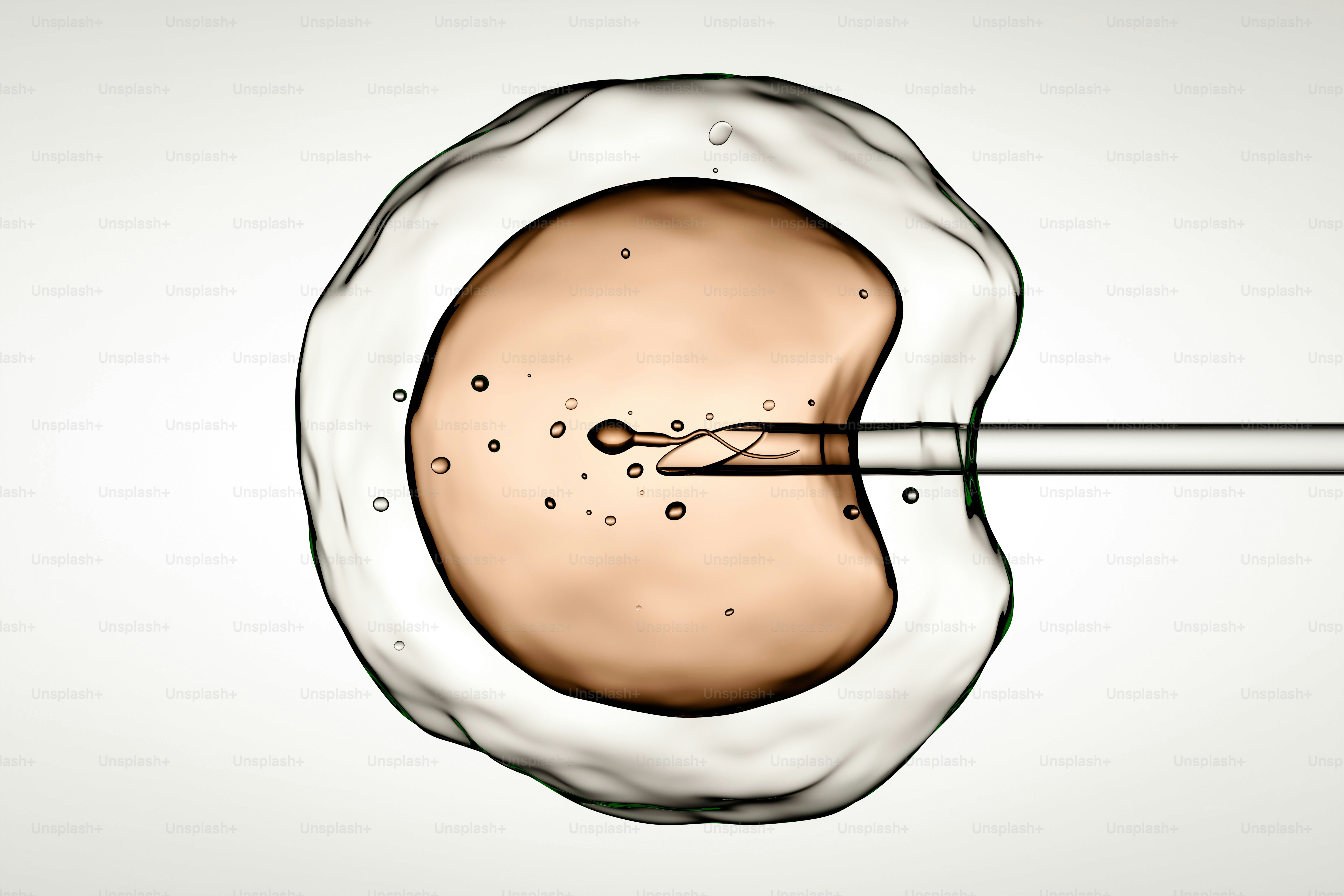 Microscopic injection of sperm into an egg cell for fertilization.