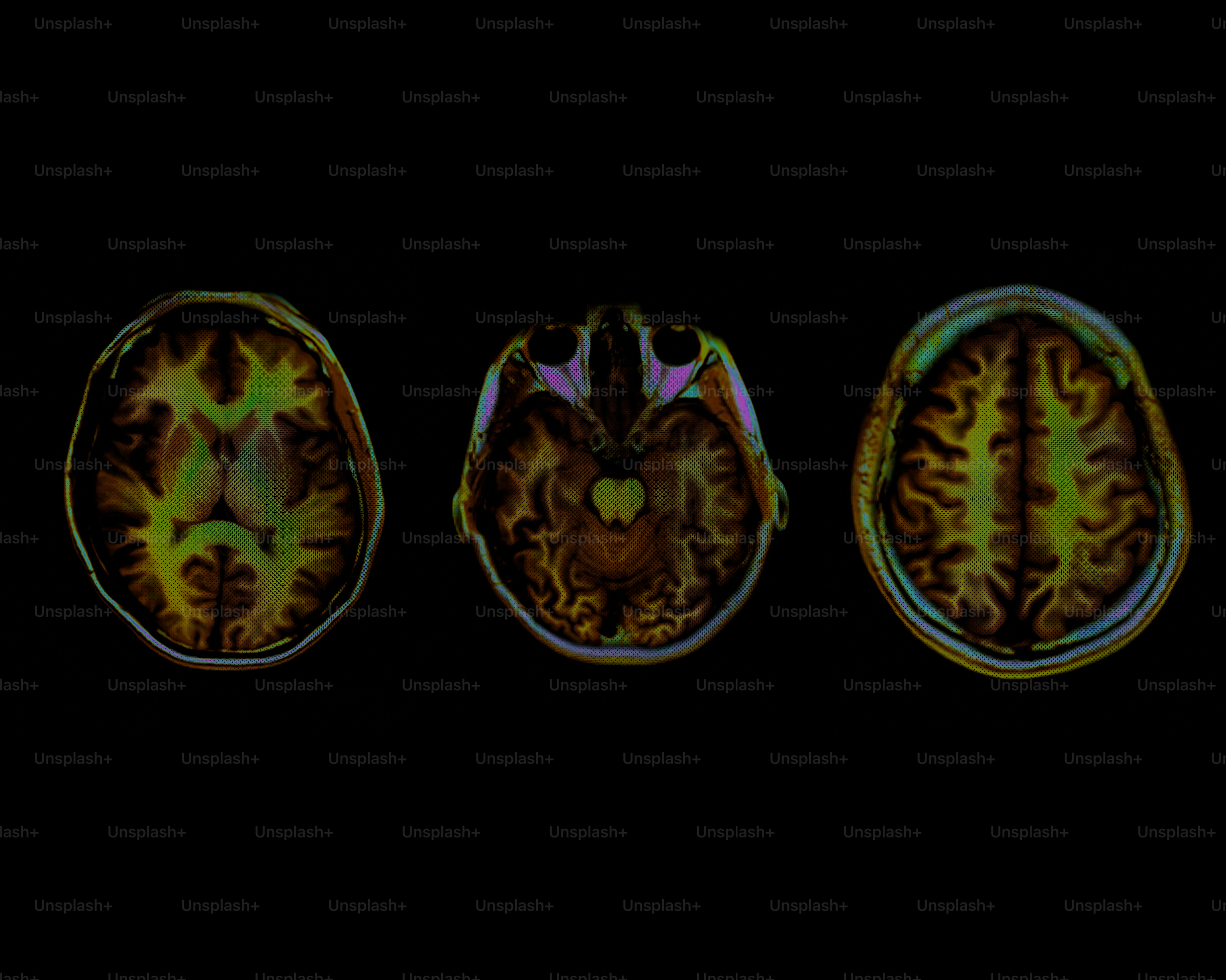 Three colorful human brain scans on a black background.