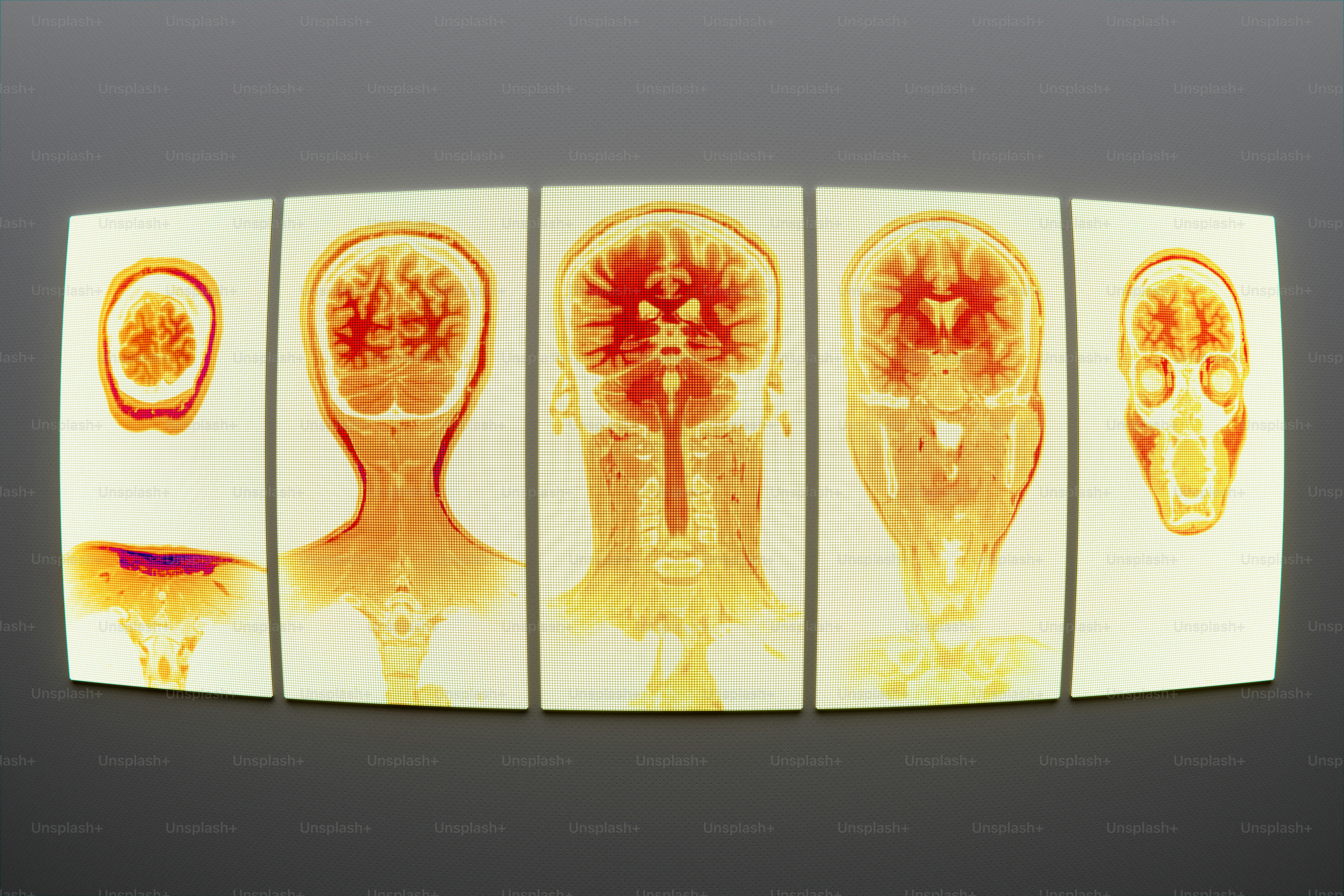 Anatomical cross-sections of human brain and head.
