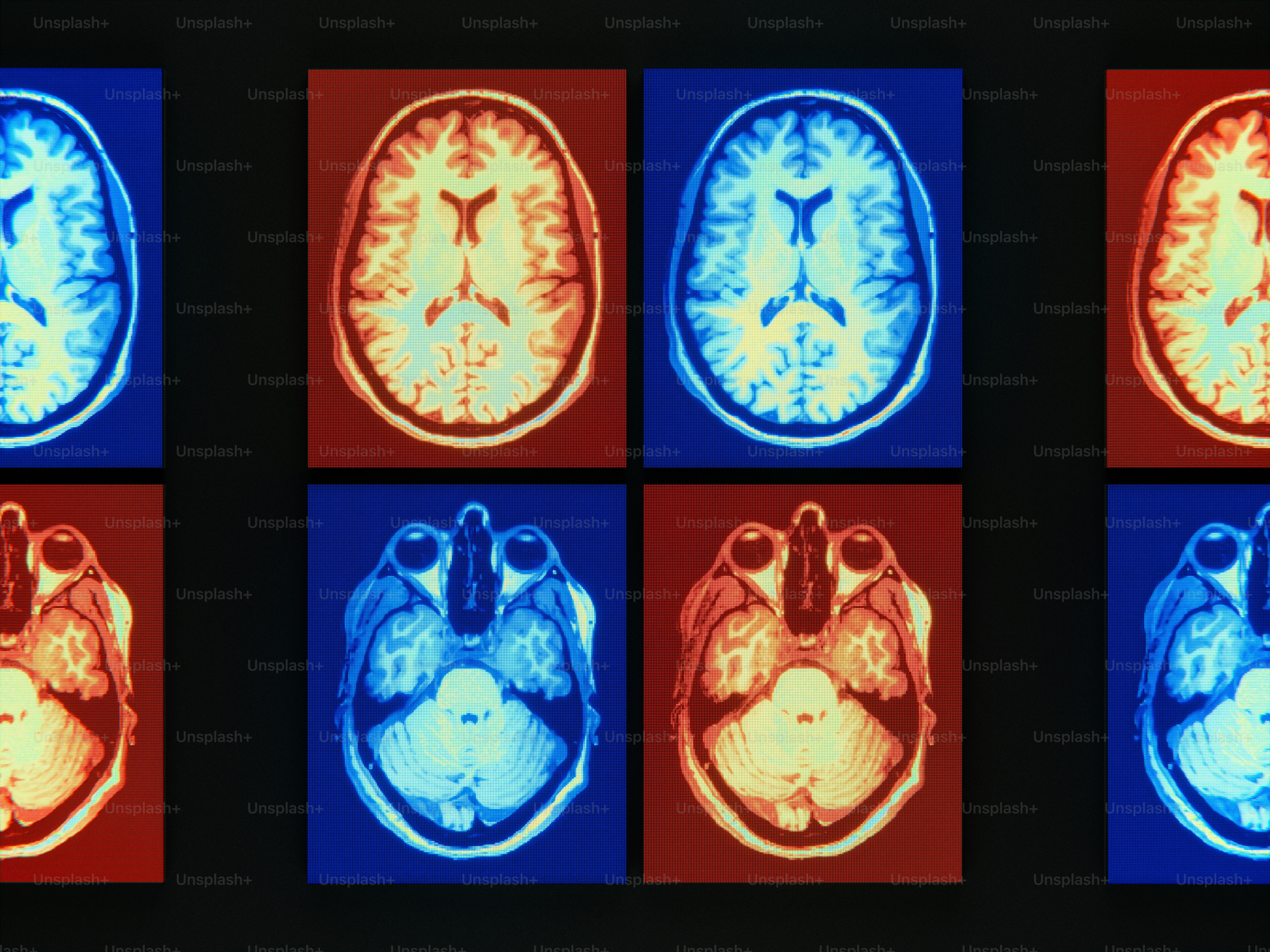 Human brain scans in a red and blue grid.