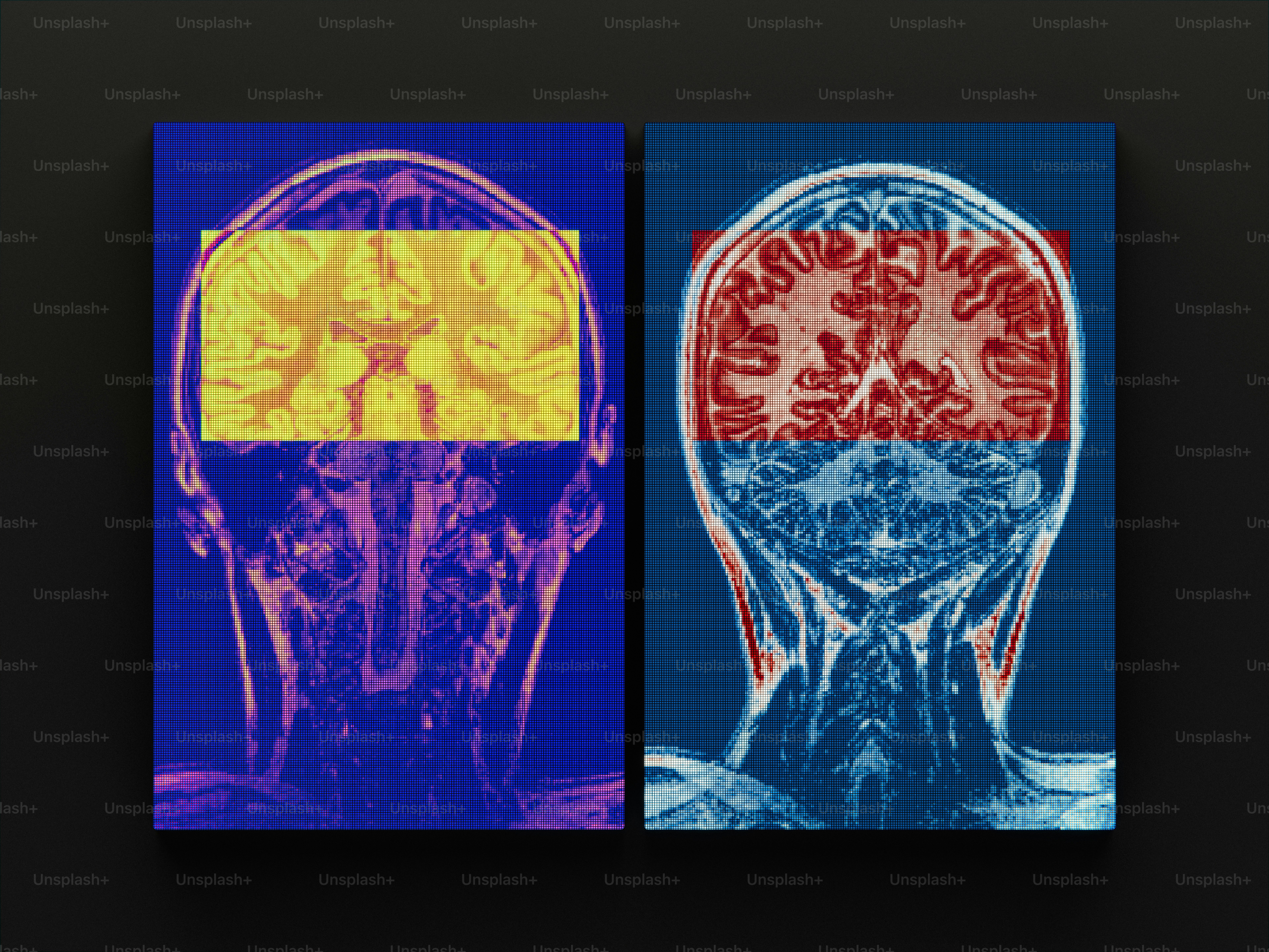Two vibrant mri brain scans displayed side-by-side.