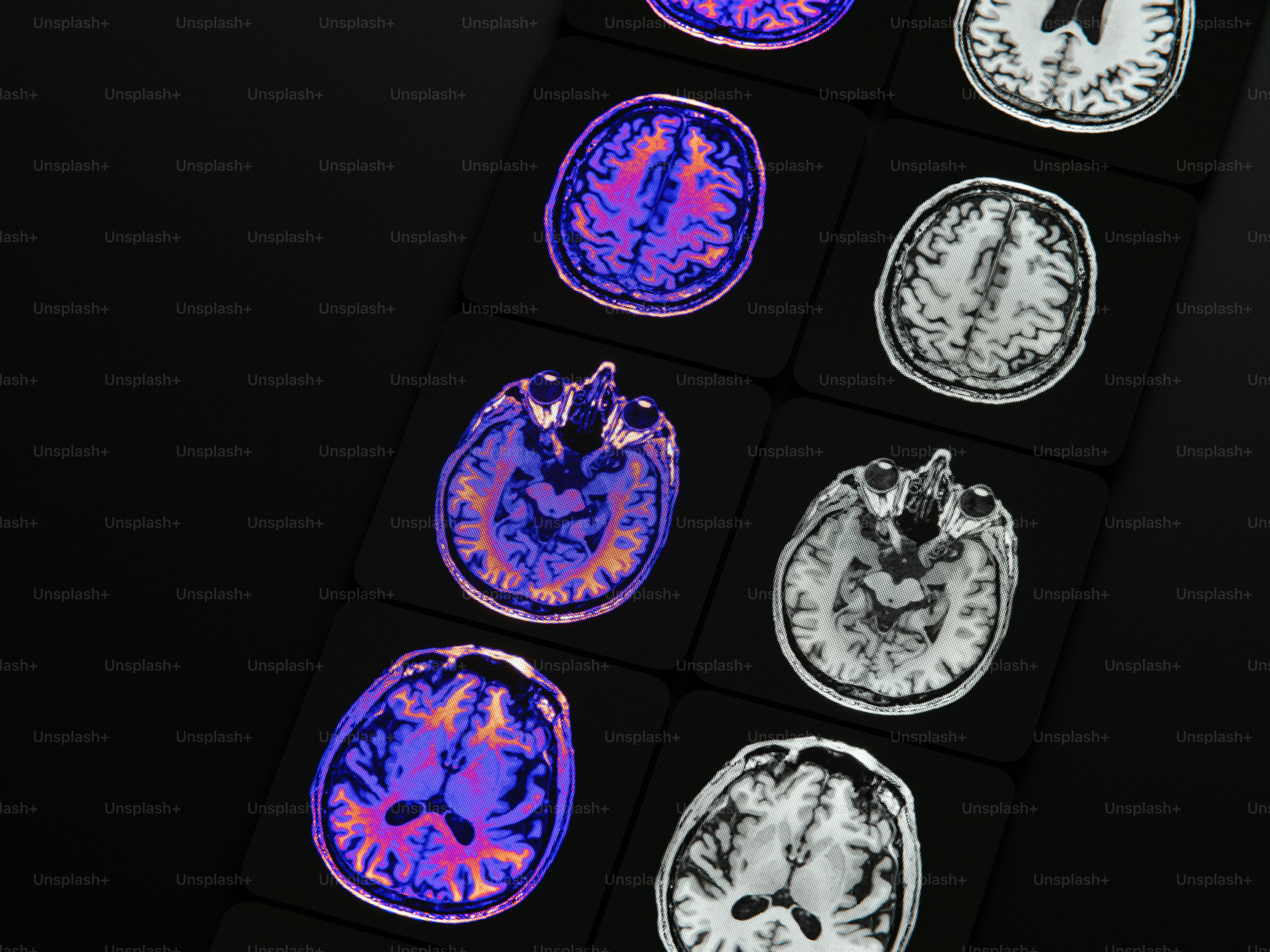 Multiple brain scans, some colored, displayed on a dark background.