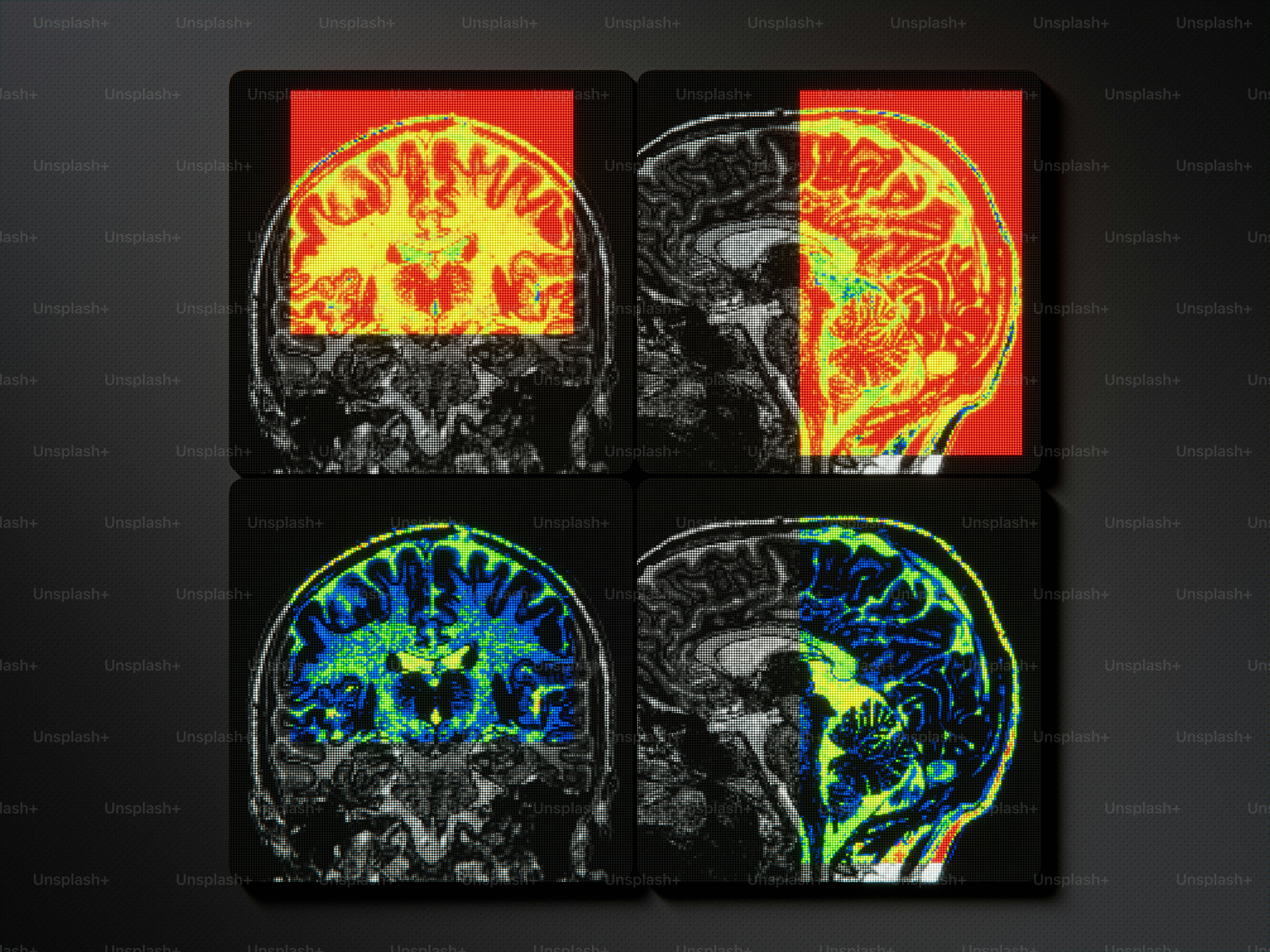 Four colorful medical scans of a human brain.