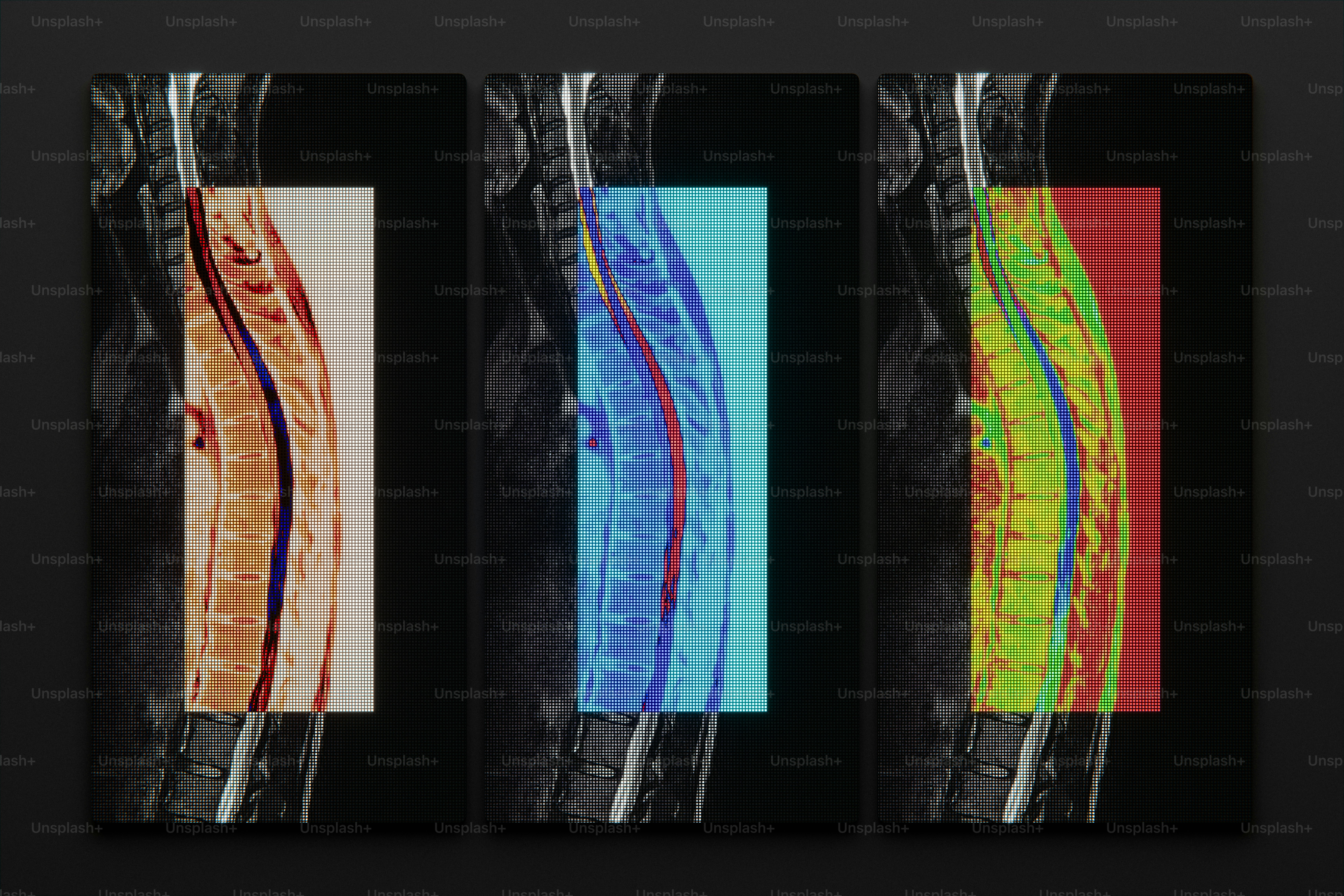 Three medical scans of a human spine with colorful overlays