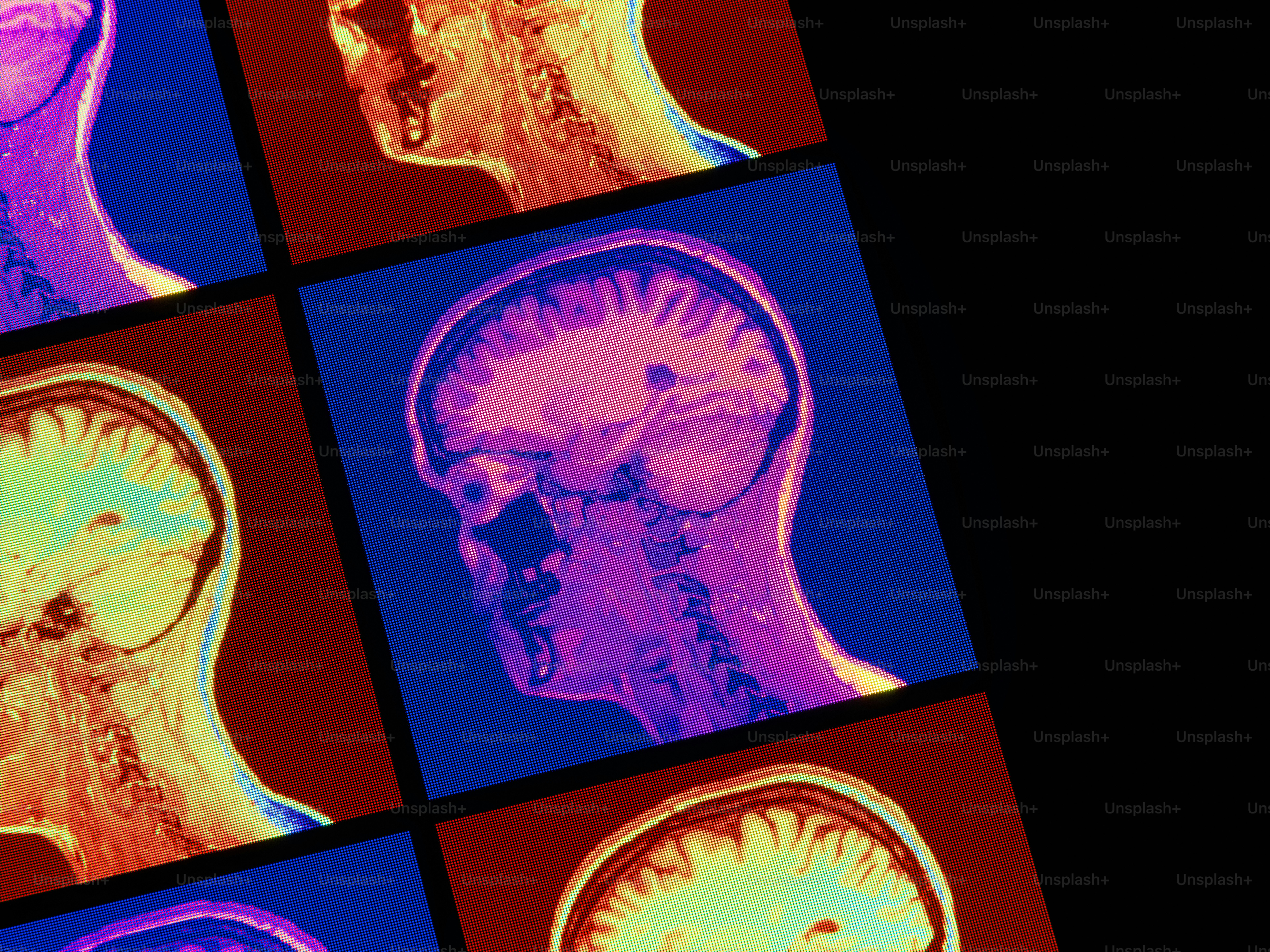 Colorful mri scans of human brains on a dark background.