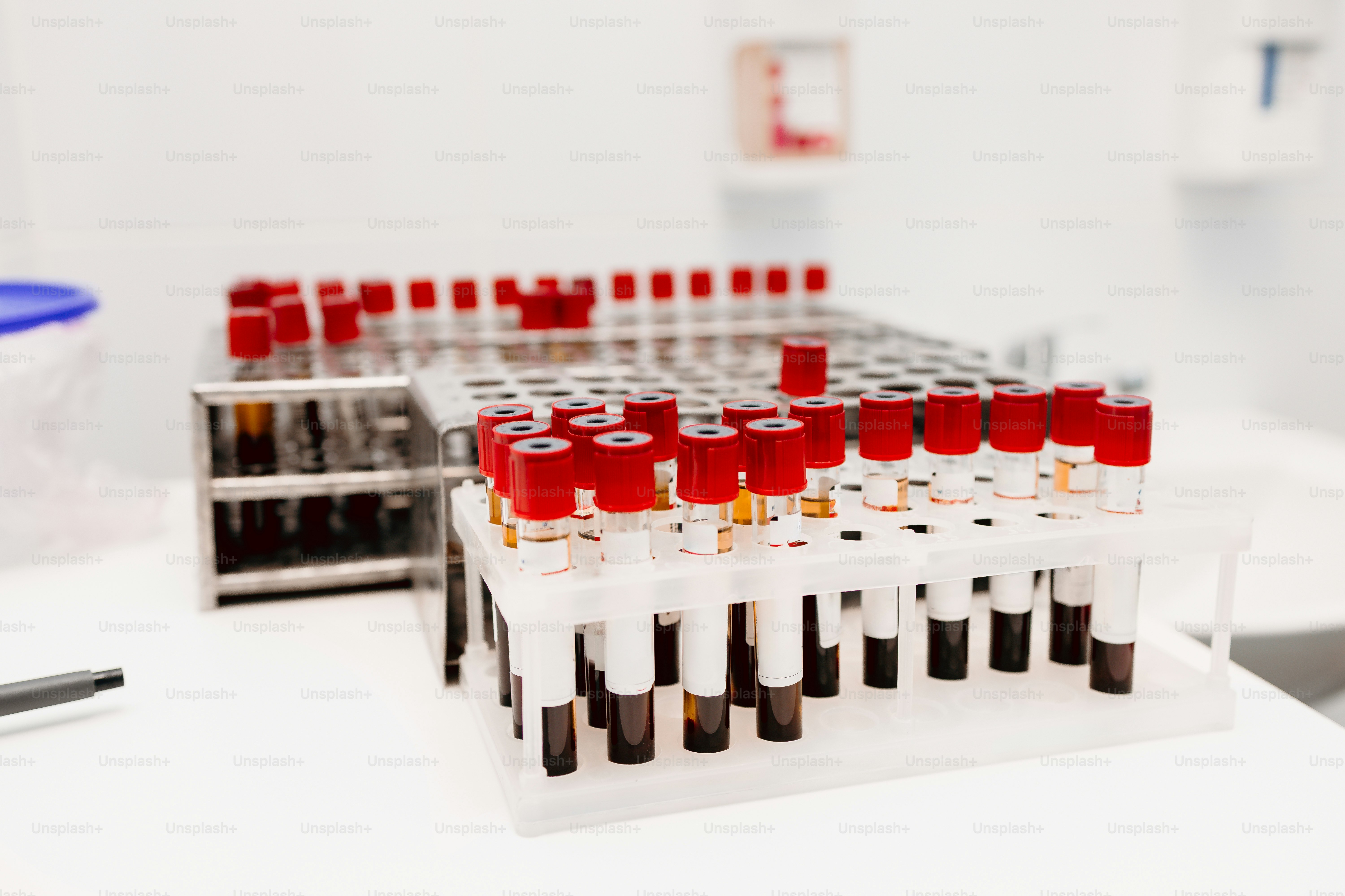 Test tubes in laboratory rack - Photo on Unsplash+