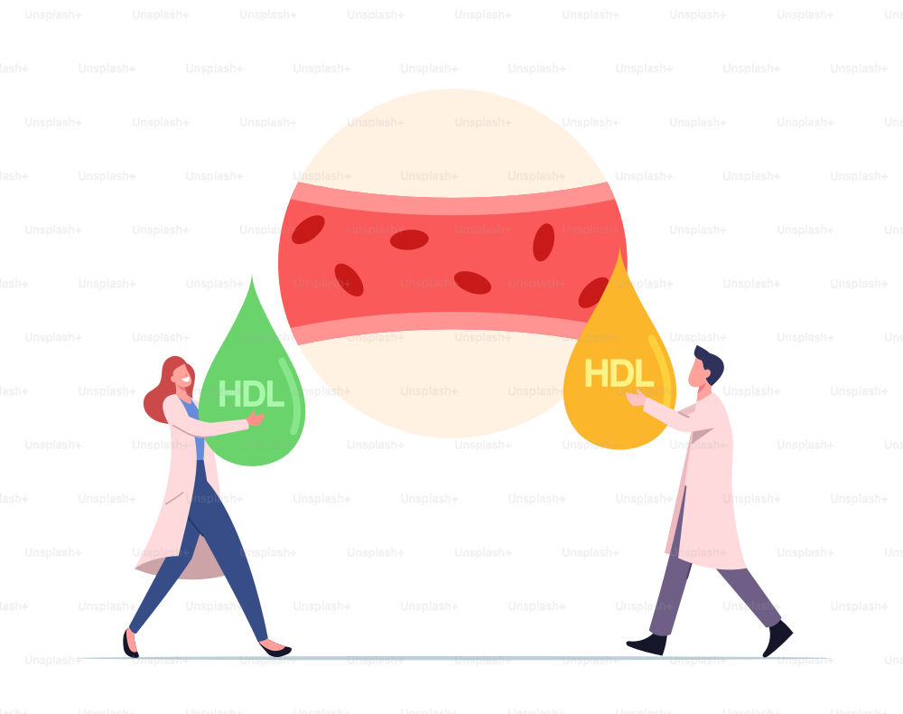 Health Care Concept. Tiny Medic Characters at Huge Human Blood Artery Holding Good and Bad HDL Cholesterol Drops. Atherosclerosis Infographics, Normal Blood Vessel. Cartoon People Vector Illustration