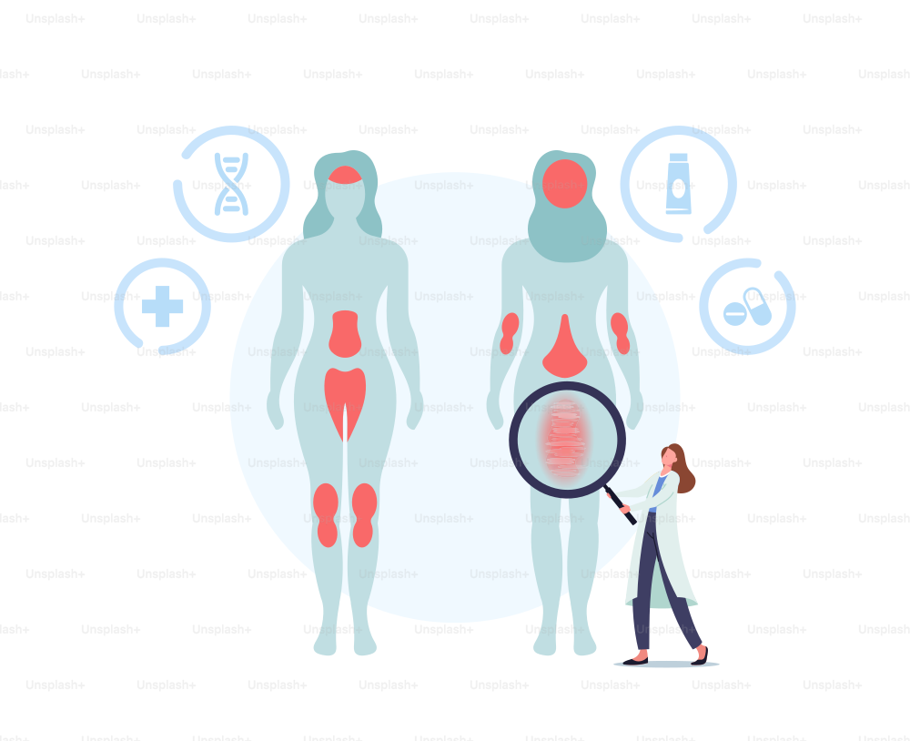 Psoriasis Concept. Doctor Character Show Affected Areas on Human Body. Autoimmune Skin Disease. Labeled Structure with Scales, Plaque, Widened and Twisted Blood Vessels. Cartoon Vector Illustration