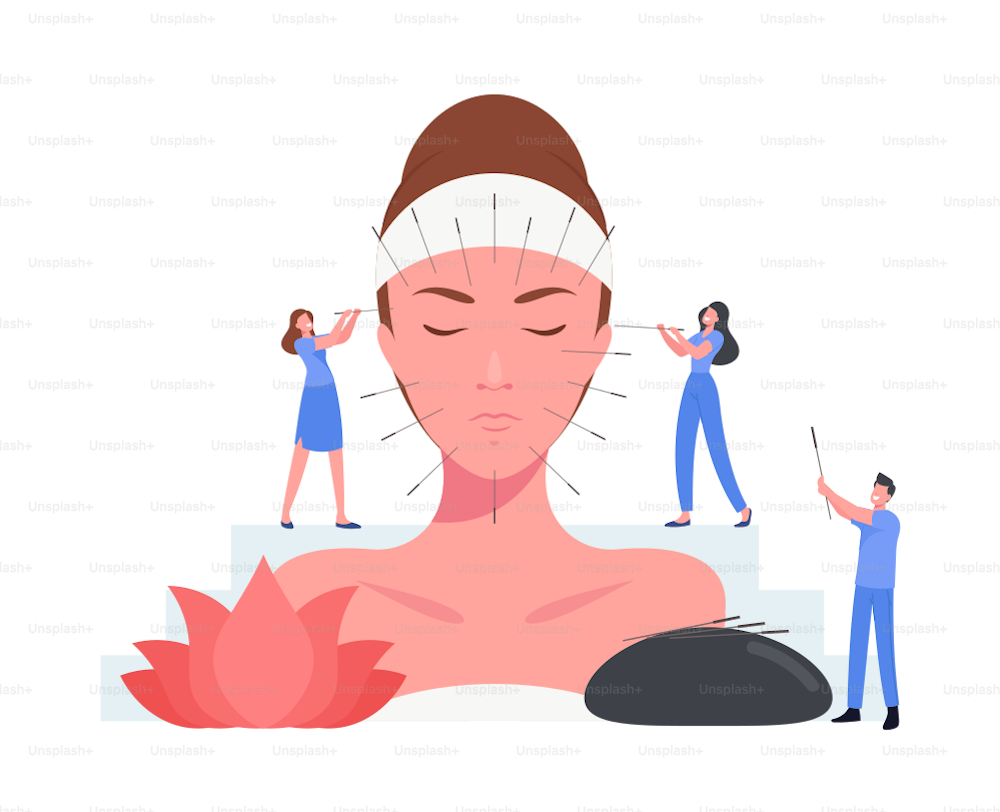 침술 중국 치료 개념. 작은 캐릭터는 거대한 여성의 얼굴에 바늘을 주입합니다. 신체 주사 지점이있는 대체 의학 형태. 질병 예방. 만화 사람들 벡터 일러스트레이션