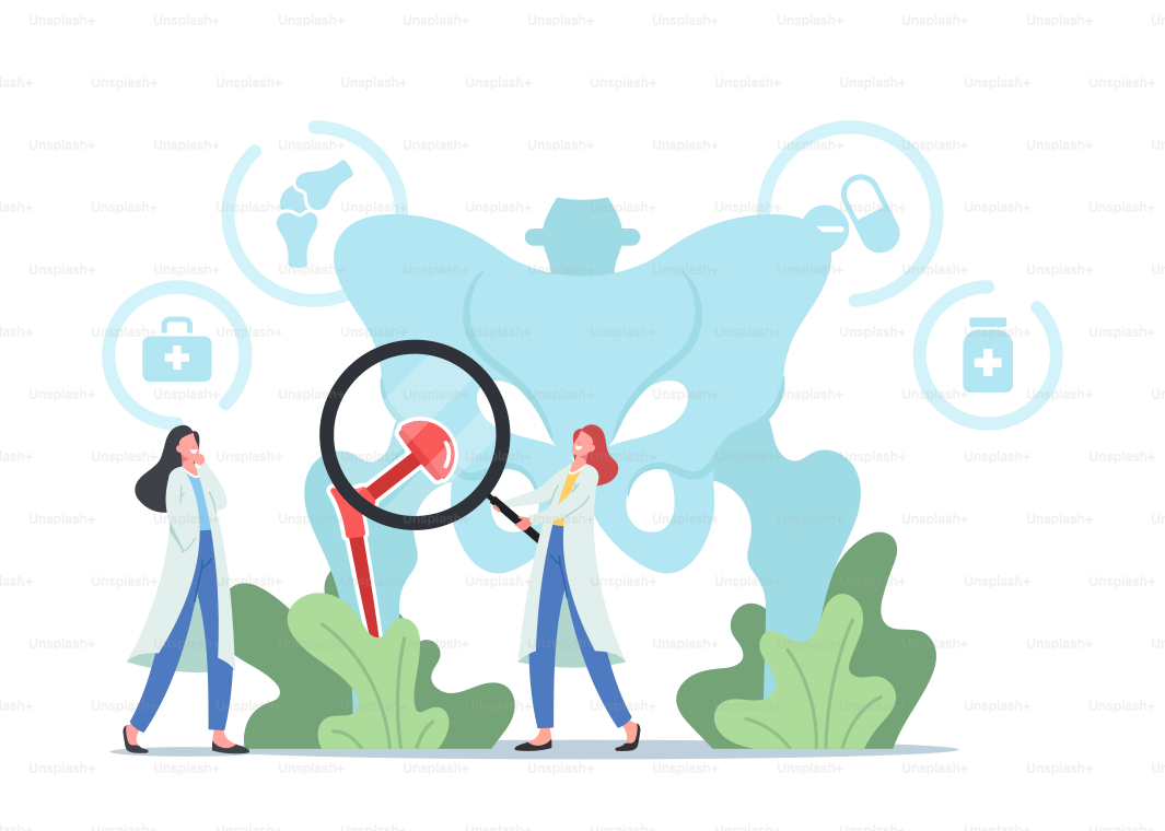 Tiny Doctors Characters with Magnifying Glass at Huge Human Pelvic Bones with Total Hip Prosthesis Implant. Arthroplasty, Osteoarthritis, Hip Replacement Concept. Cartoon People Vector Illustration