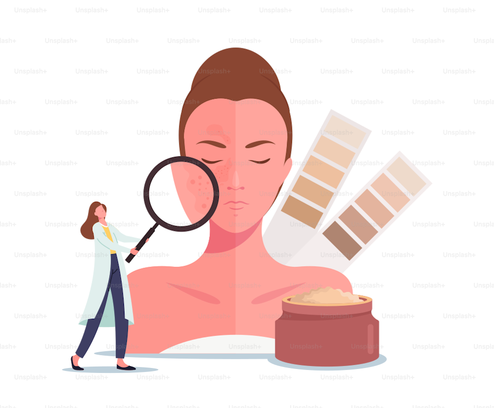 Skin Whitening or Lightening Concept. Tiny Cosmetologist Doctor Character with Huge Magnifying Glass and Color Scale Look on Woman Face with Dark Spots or Freckles. Cartoon People Vector Illustration