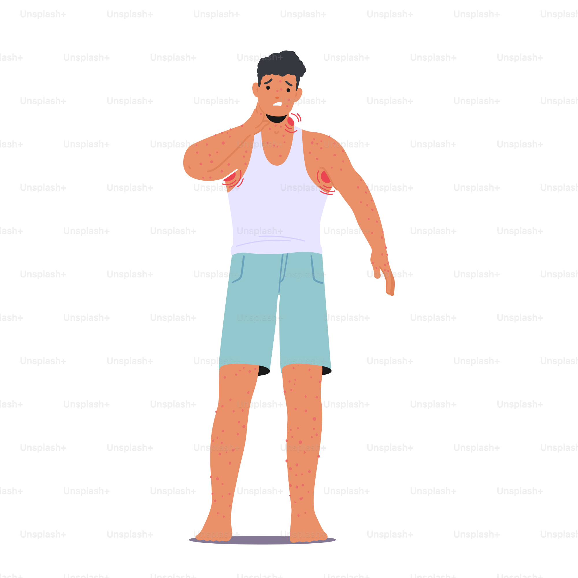 Monkey Pox Outbreak Concept. Sick Male Character with Monkeypox Virus Symptoms Swollen Lymph Nodes and Bleeding Pustules on Body. Dangerous Infectious Disease. Cartoon People Vector Illustration