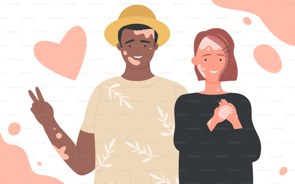 Menschen mit Vitiligo-Vektorillustration. Cartoon-Porträts von positiven Männer- und Frauenfiguren, die zusammenstehen. Body Positive, Selbstliebe und Depigmentierungskrankheit, Konzept des Welt-Vitiligo-Tages