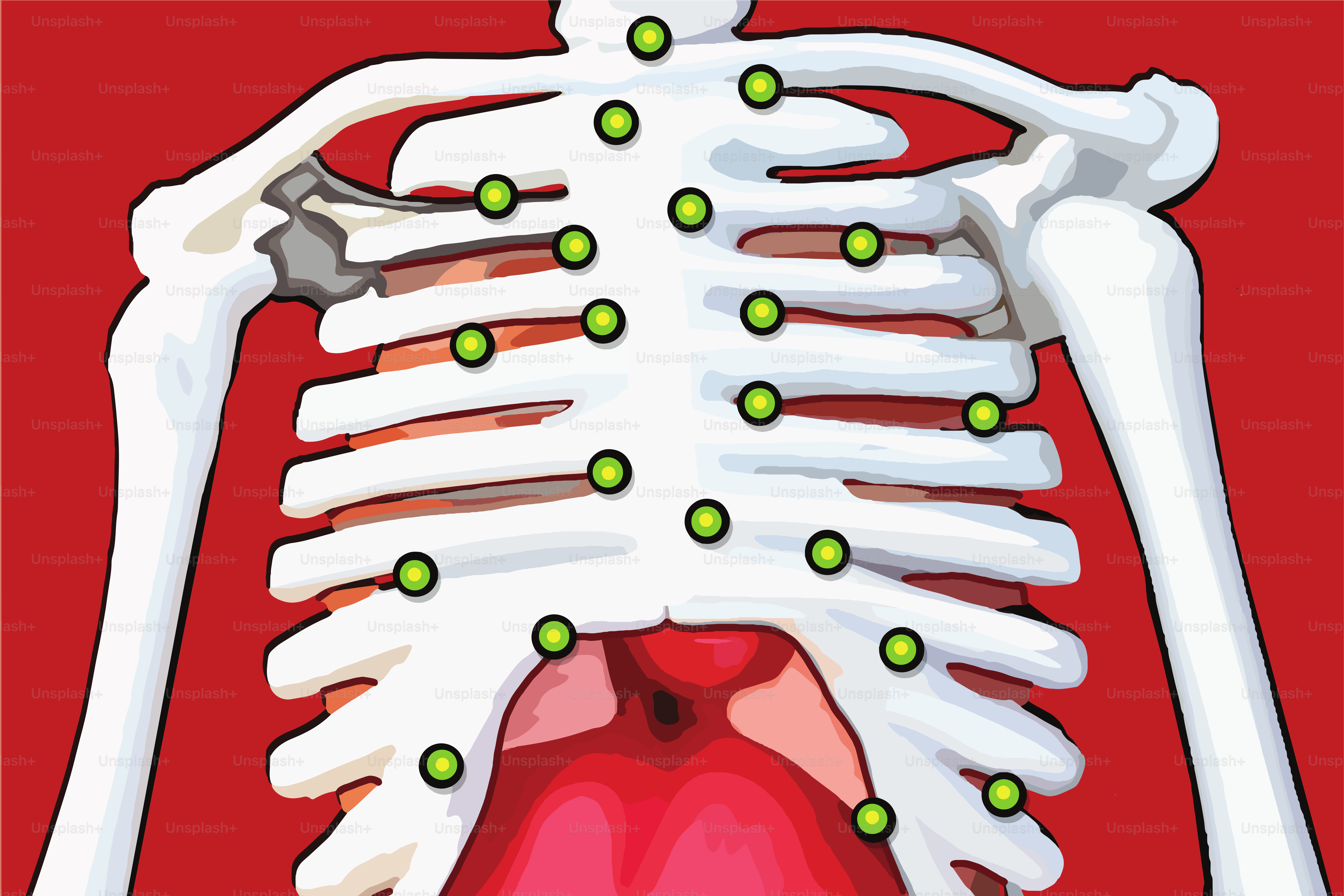 World Tuberculosis Day March 24th with perforated lungs