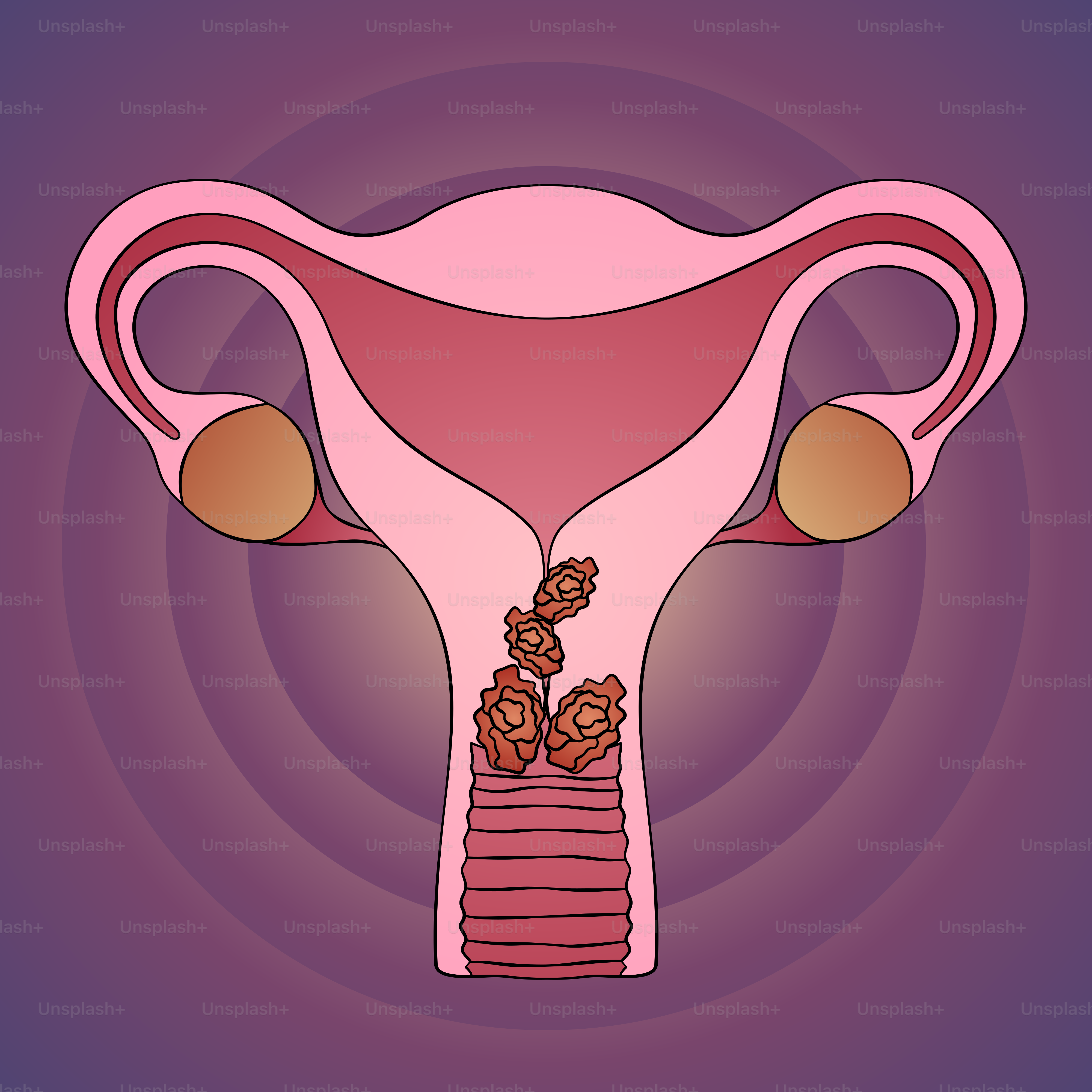 A picture of a female breast with the utensils exposed