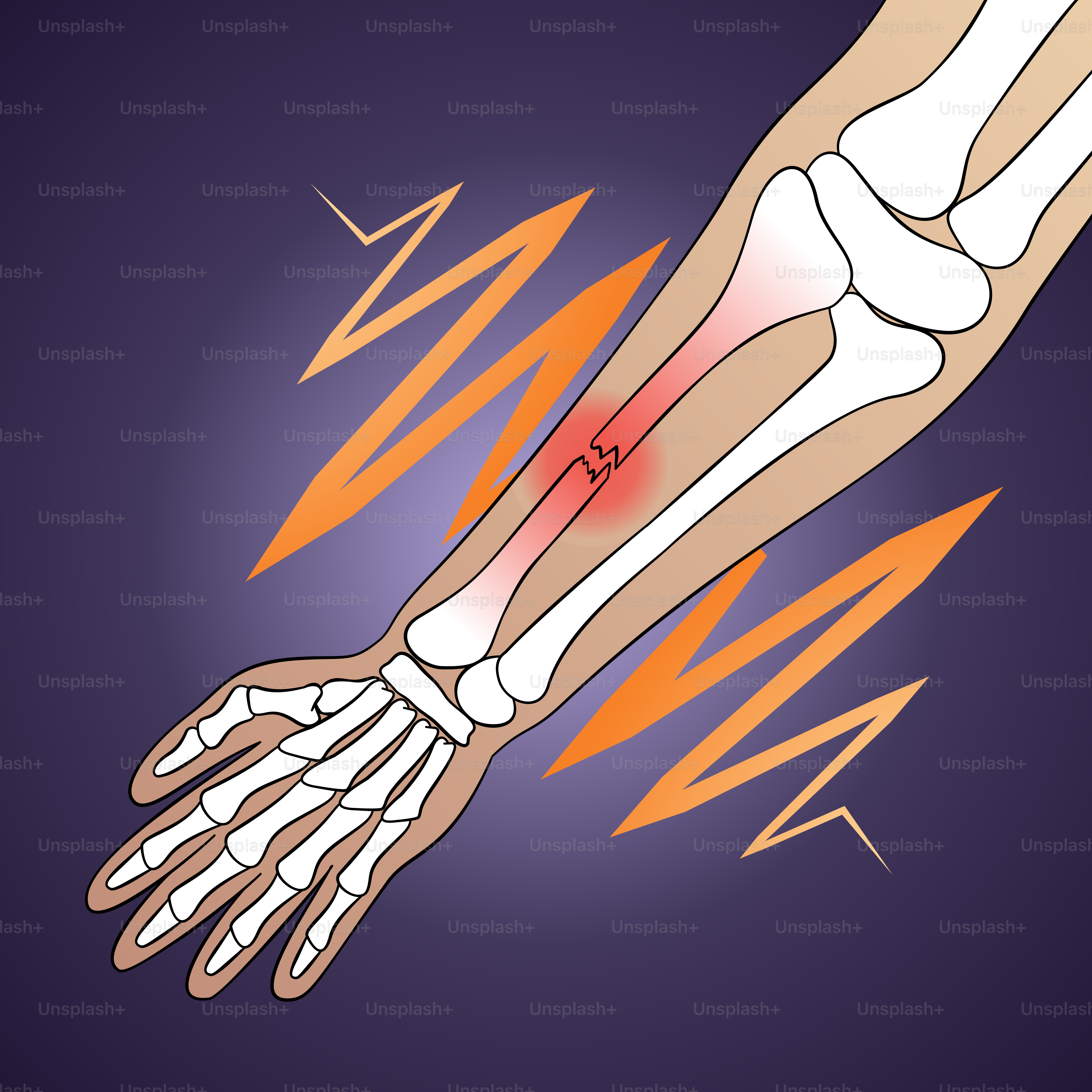 A picture of a hand with a red spot on it