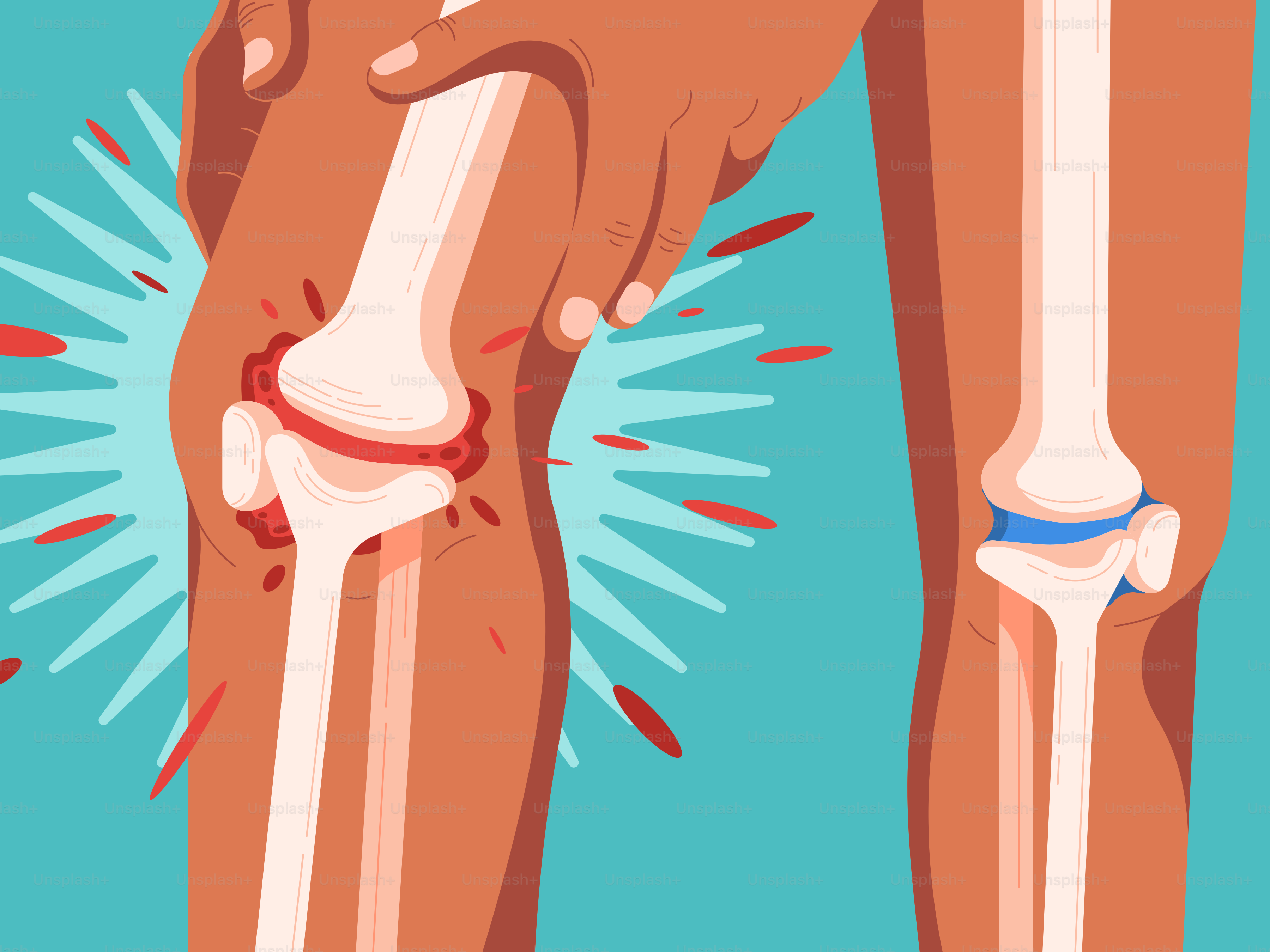 A poster of a person with a broken leg