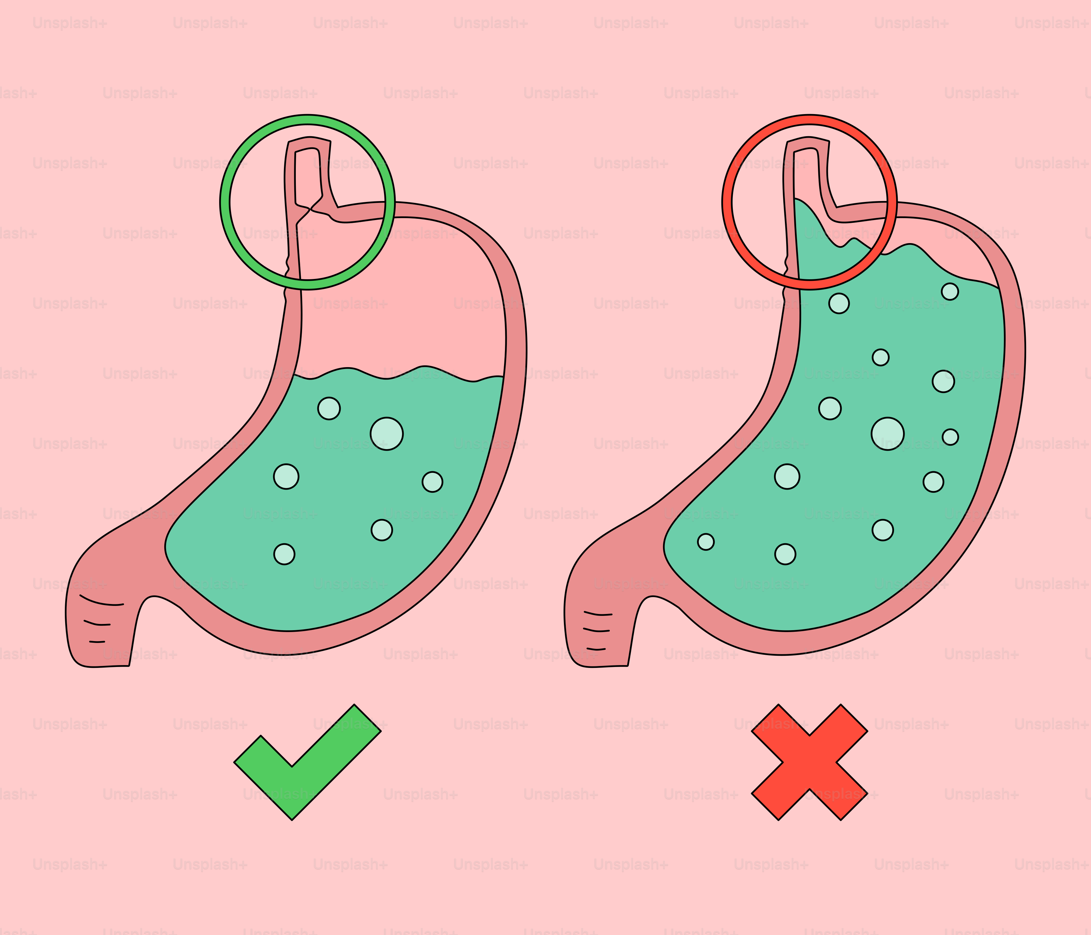 A picture of a stomach with a green tickle and a red tickle