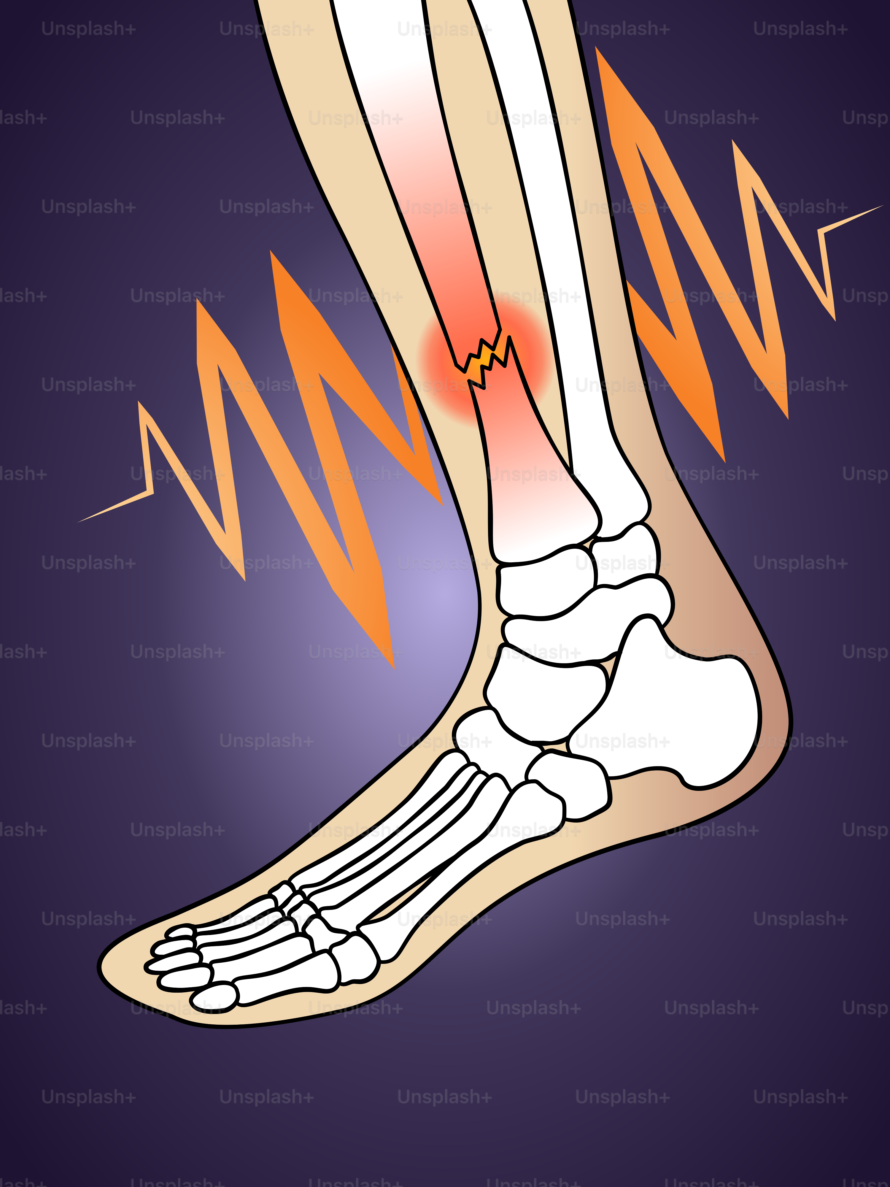 Ein Diagramm eines Fußes mit einem Spreink darauf