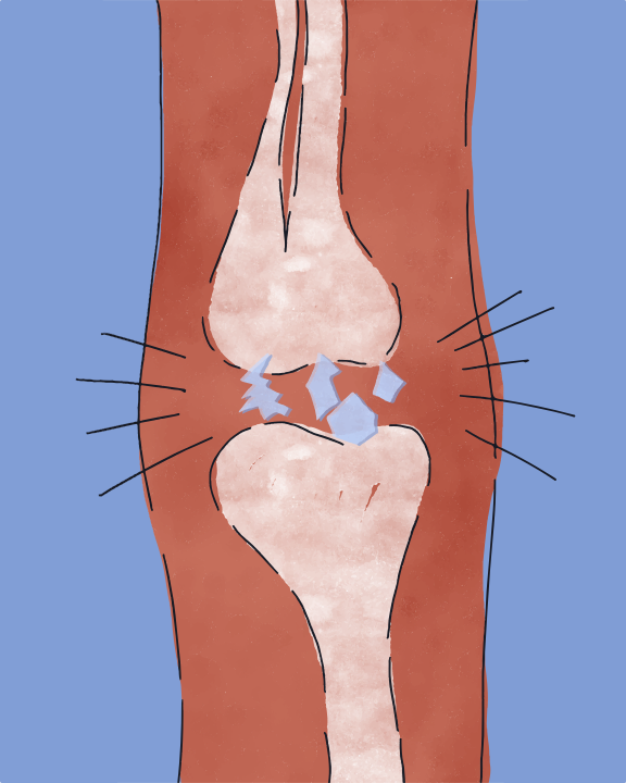 Une photo d’un genou avec une patte de chat qui en dépasse