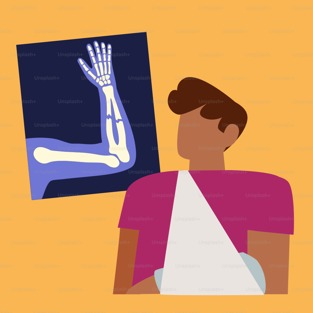 A man with a broken arm and a broken hand