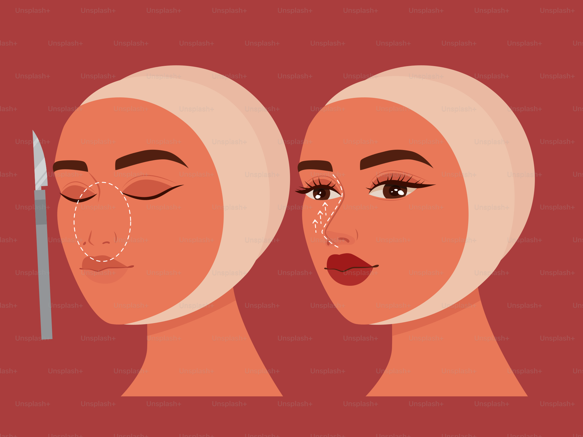 A woman with a nose surgery procedure on her nose