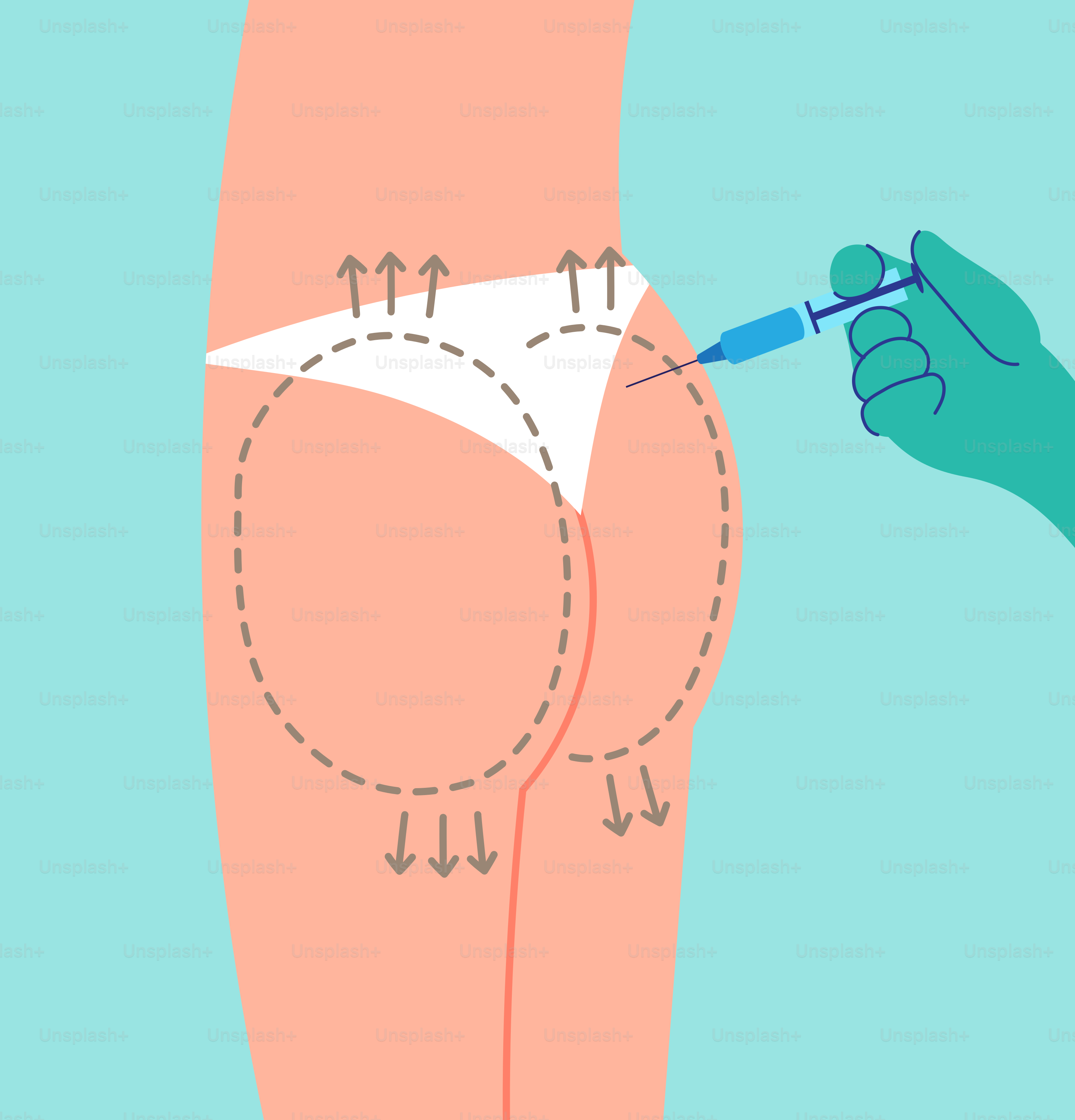 Una persona con una aguja en el