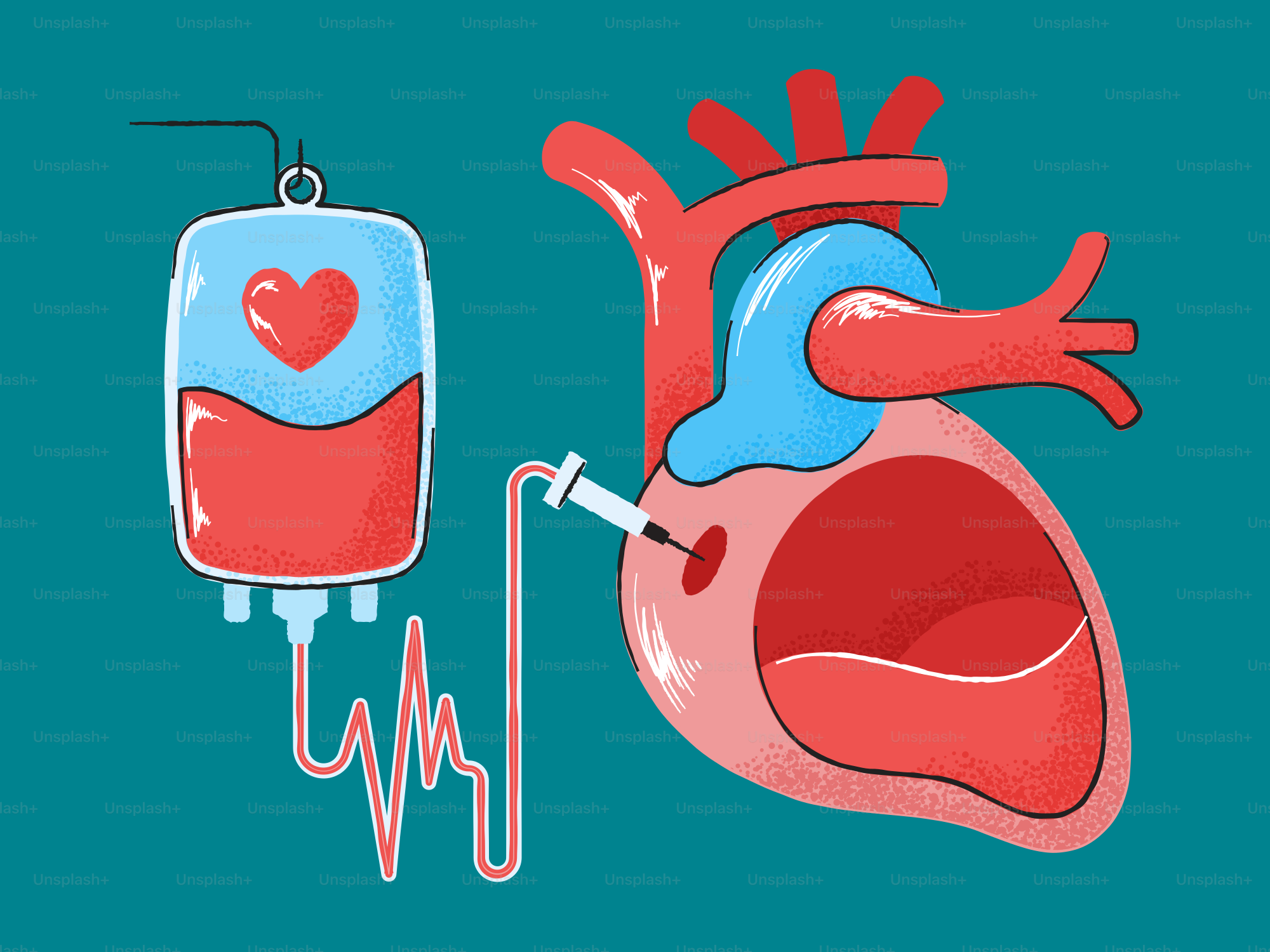 Blood bag connected to a human heart