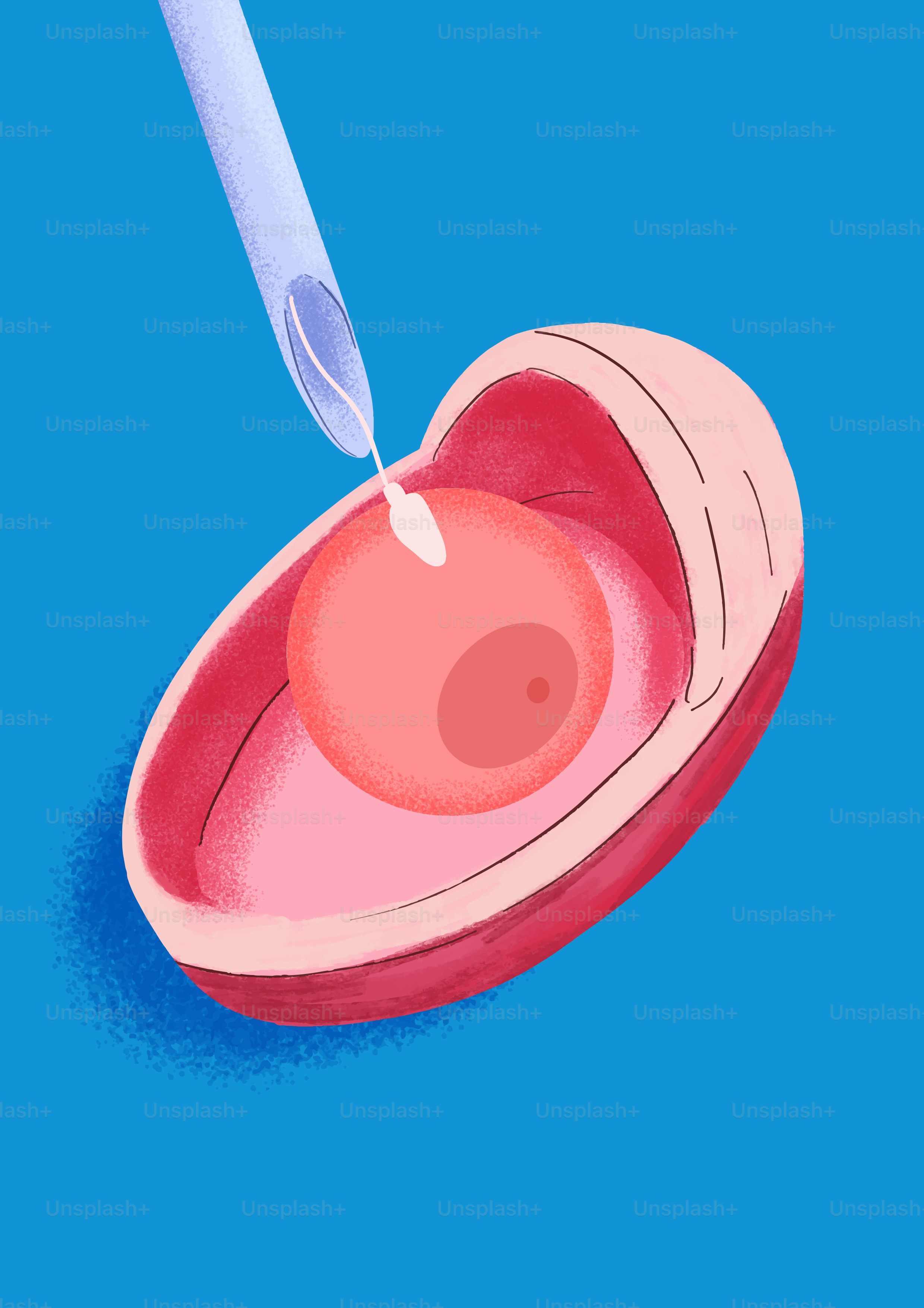 Fertilization procedure with needle and egg