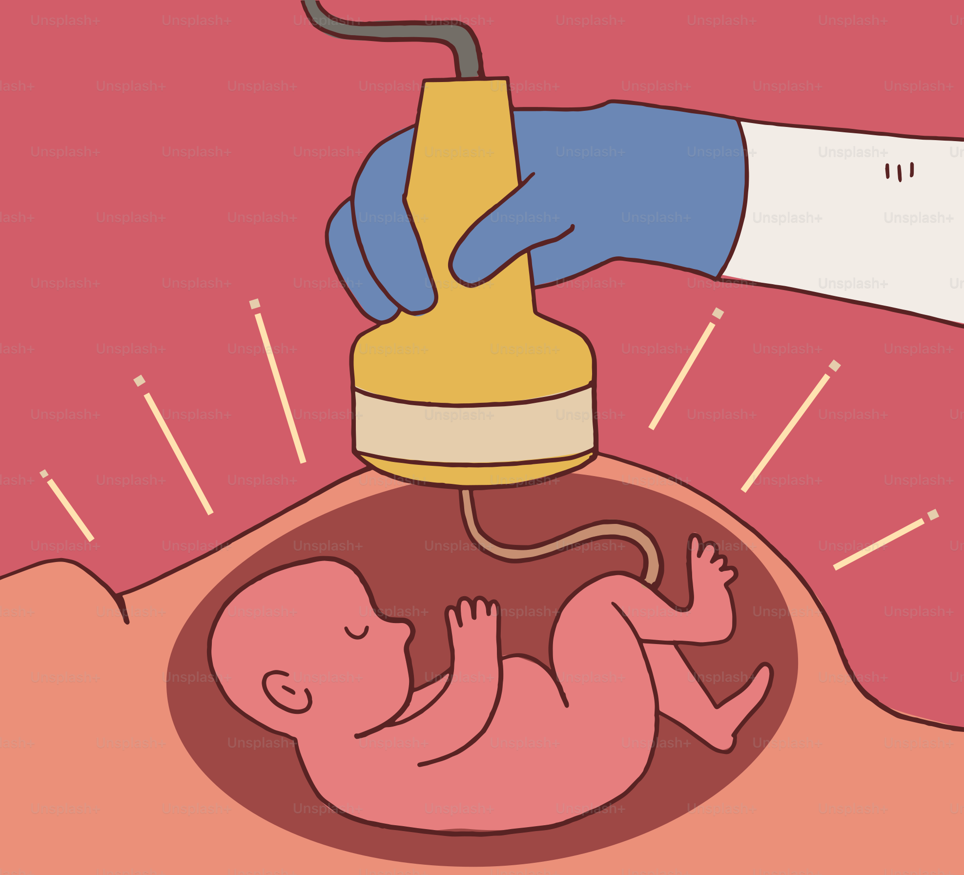 Medical ultrasound showing a baby in the womb.