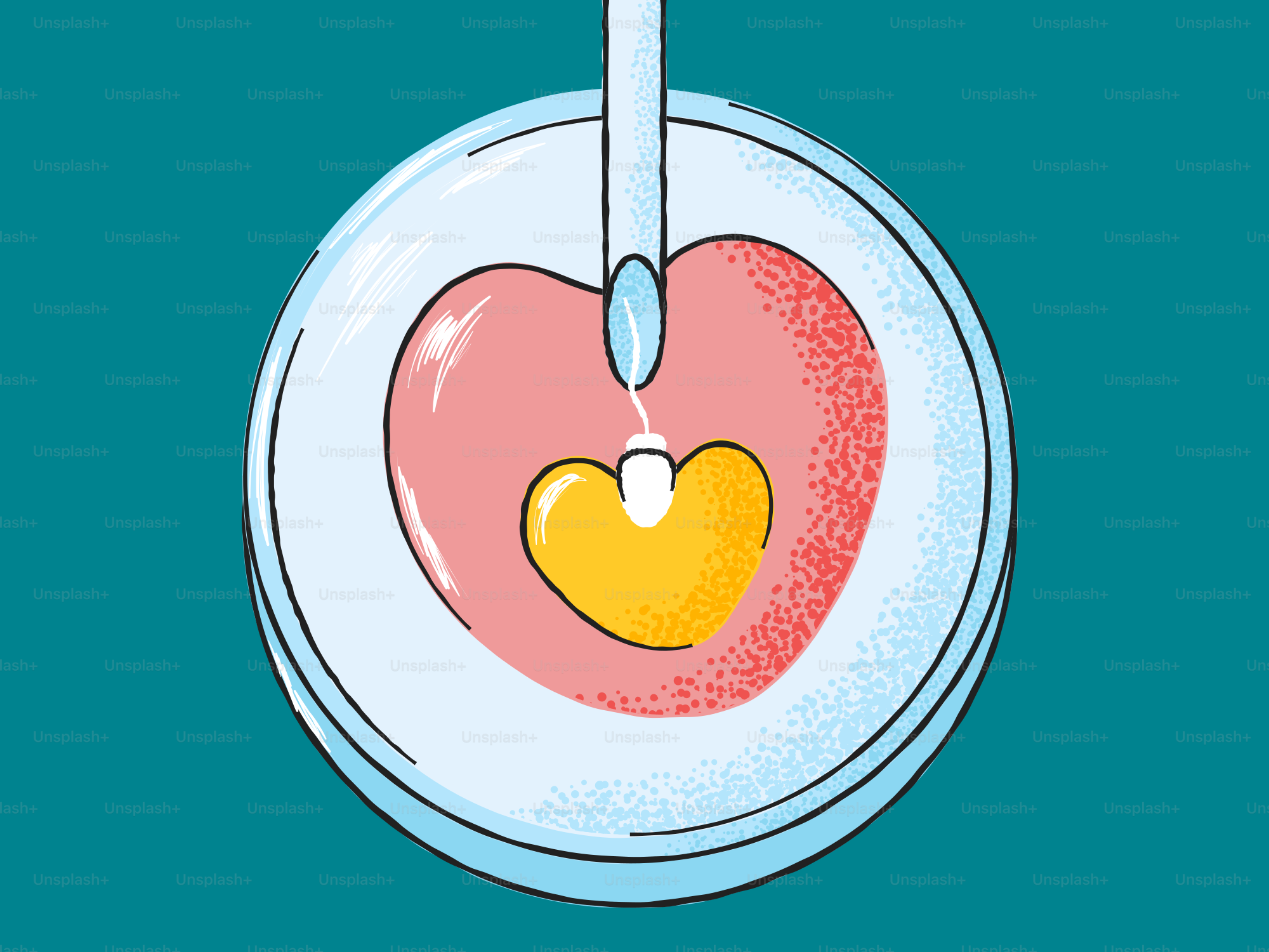 Medical procedure involving a heart and needle