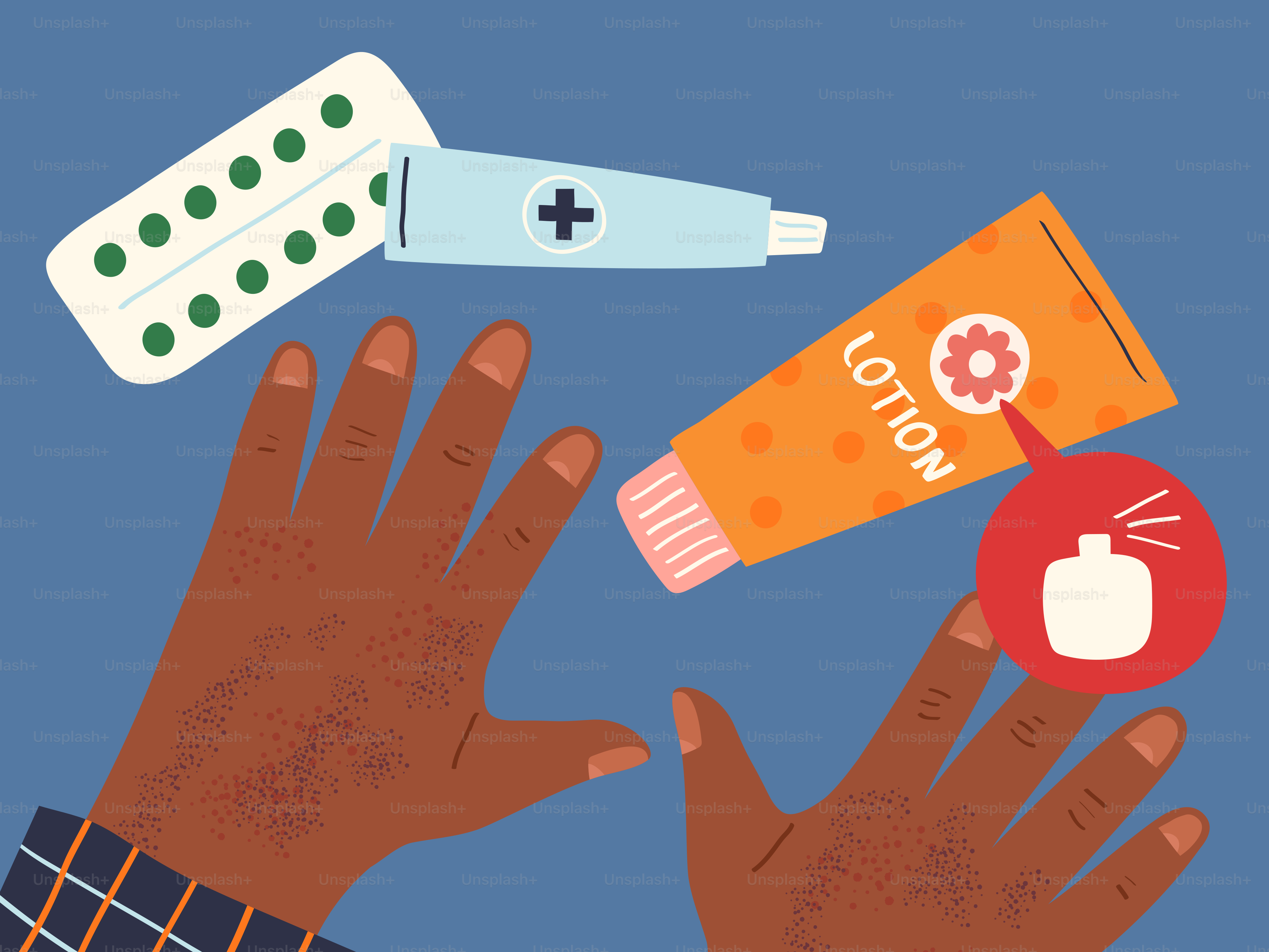 Fragrance allergy on hands treated with ointment and pills