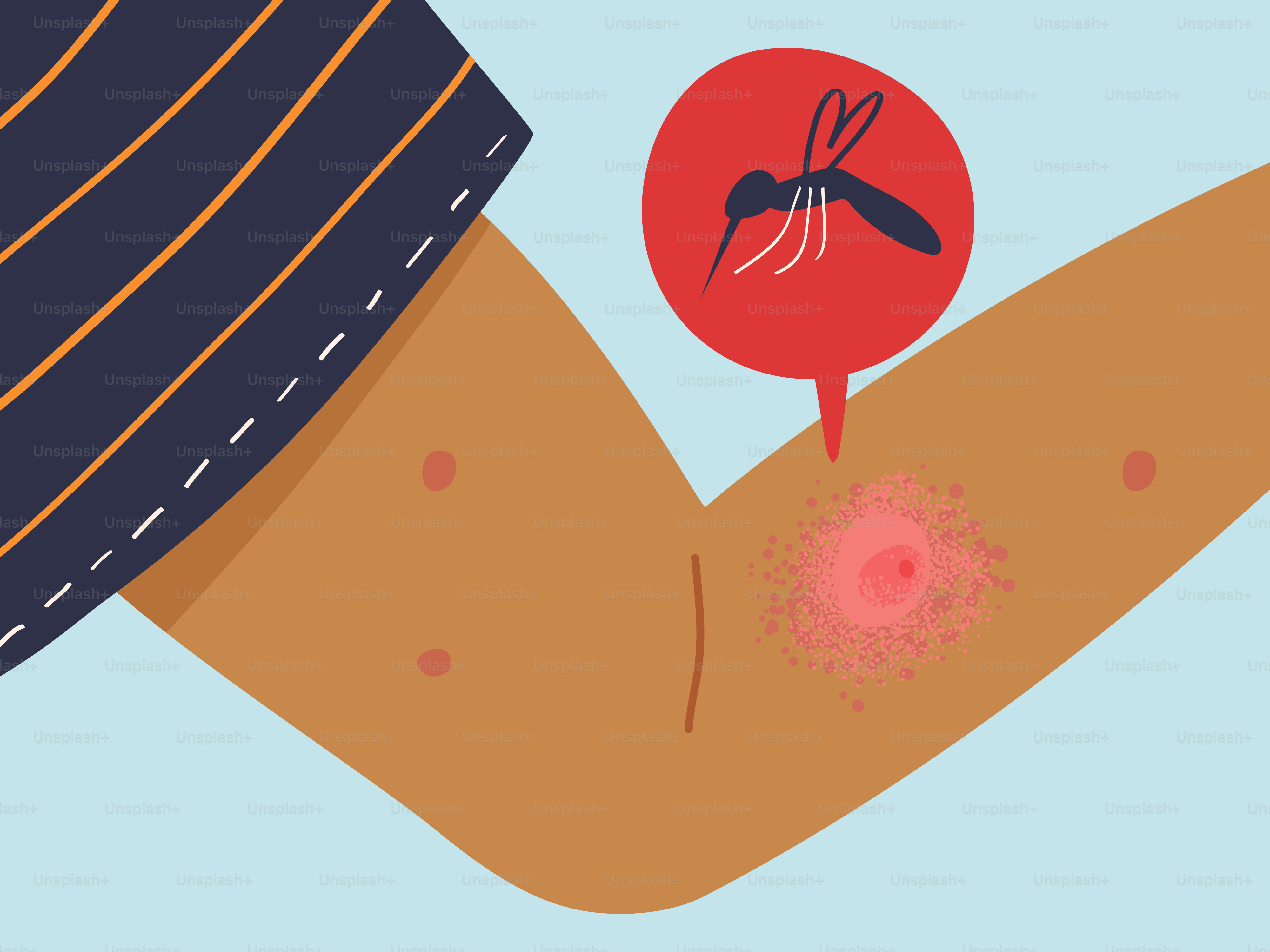 Mosquito bite causing allergic reaction on darker skin