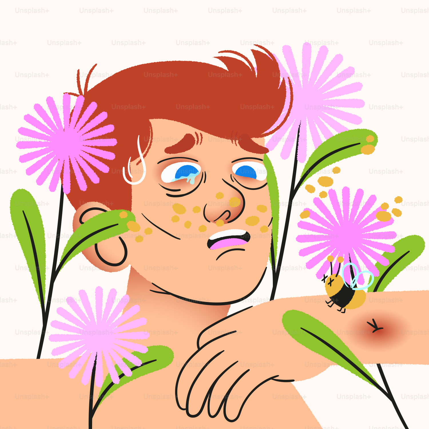 Red-haired person with pollen spots and bee sting
