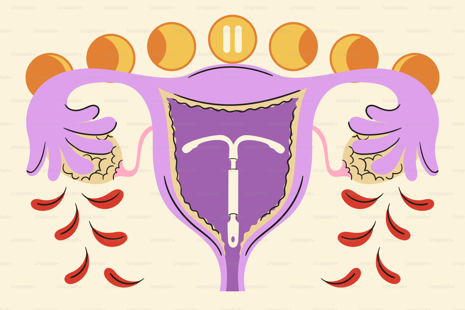 Uterus with iud, ovaries, and menstrual cycle diagram